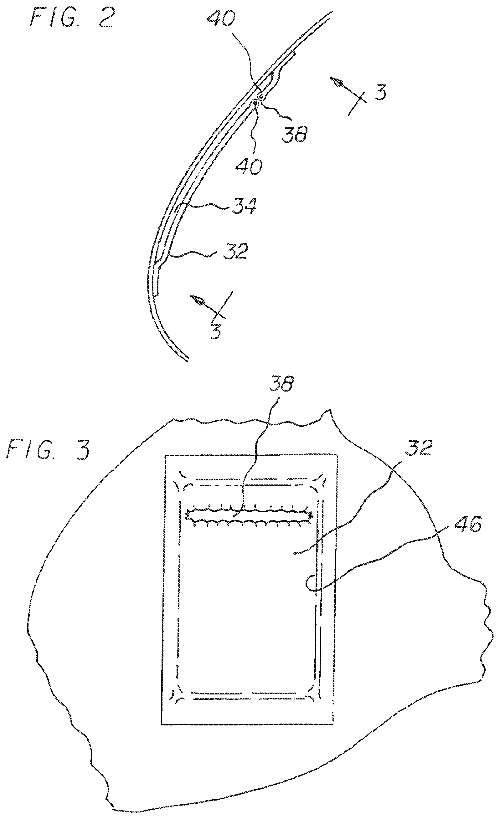 Patent US11771145 Figure 2 – Pocket bra system