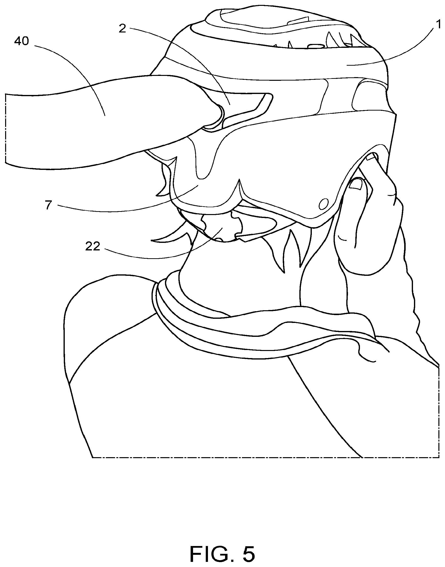 Patent US11771166 Figure 5 – Soft athletic helmet and rear closure mechanism