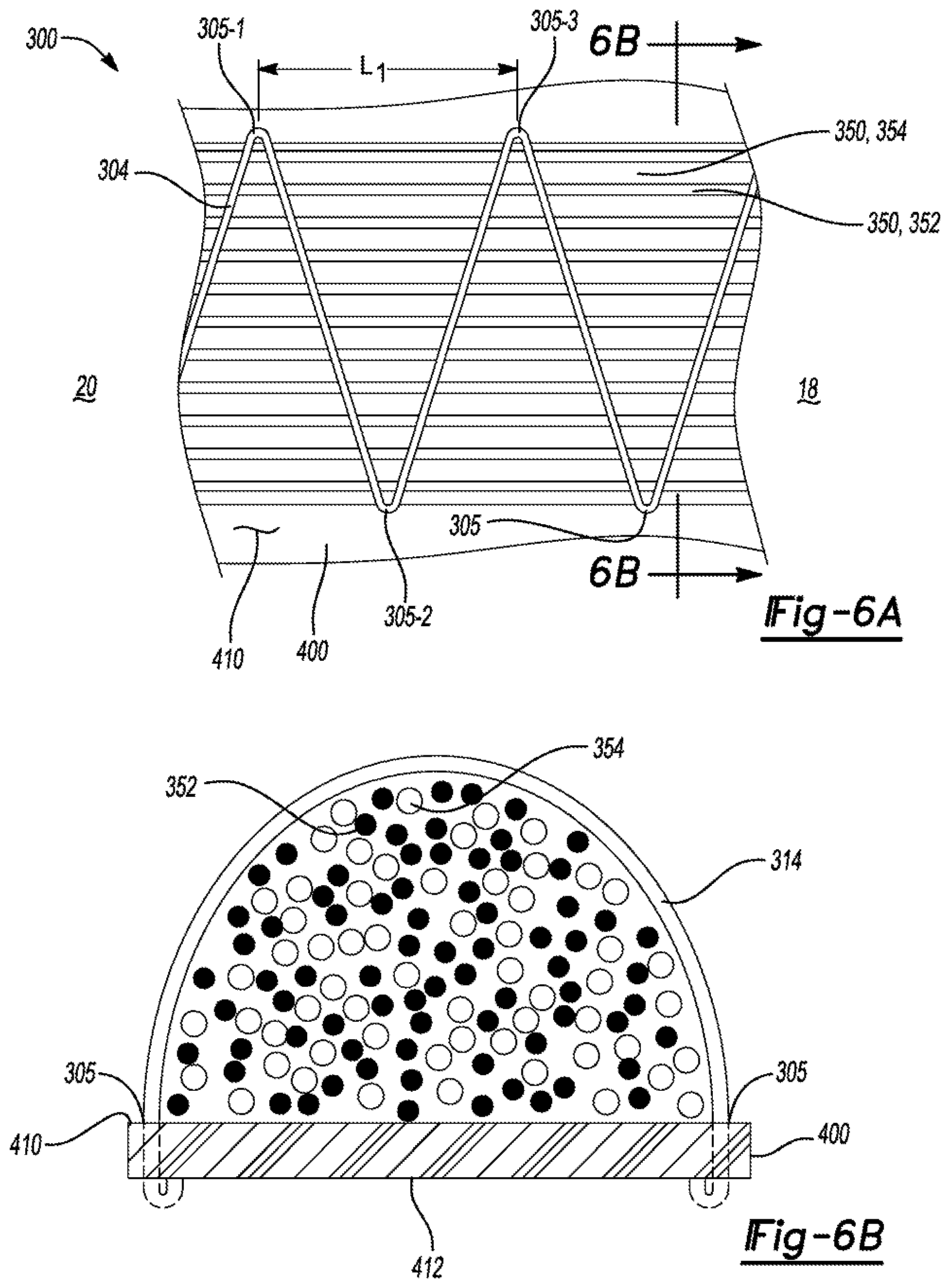Patent US11771171 Figure 4 – Composite plate for an article of footwear