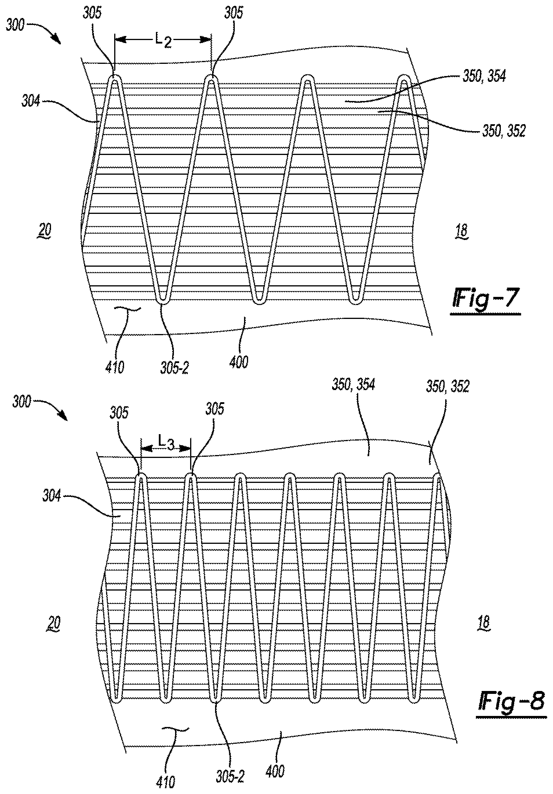 Patent US11771171 Figure 5 – Composite plate for an article of footwear
