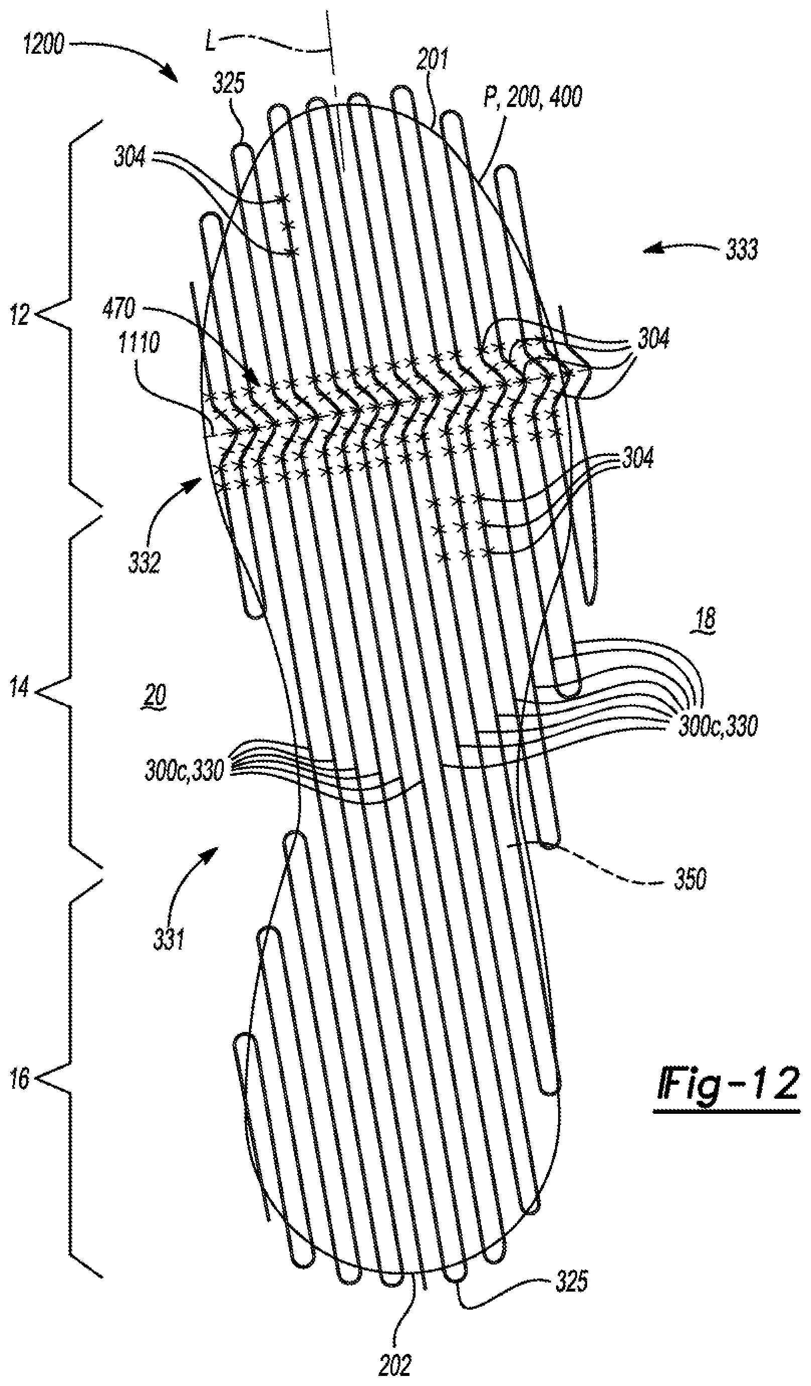 Patent US11771171 Figure 9 – Composite plate for an article of footwear
