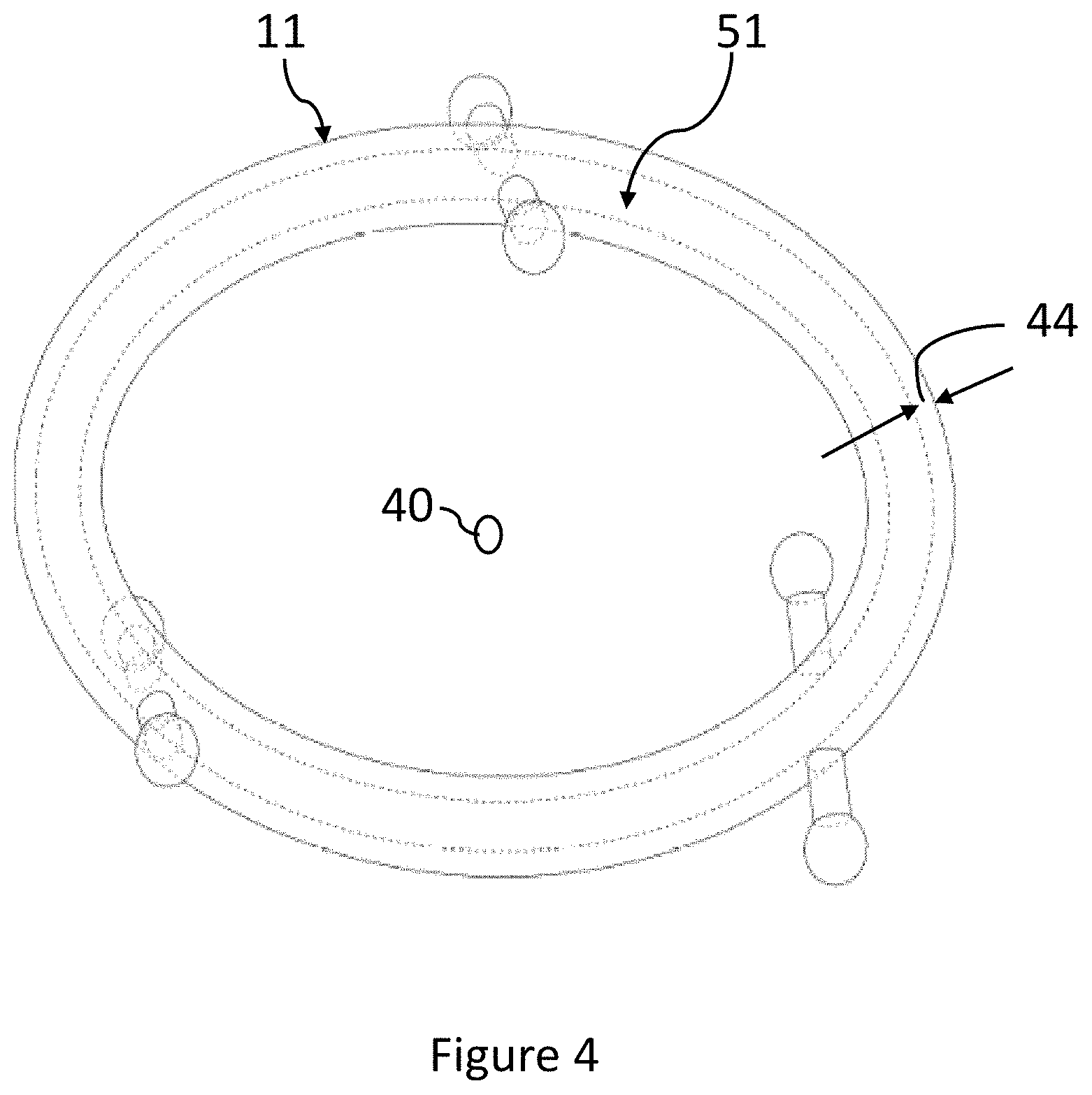 Patent US11771184 Figure 4 – Jewelry with non-precious metallic core and process for producing