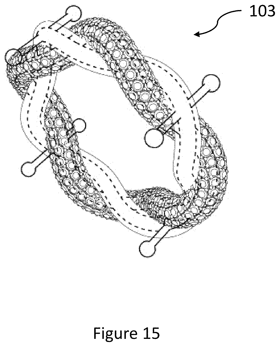 Patent US11771184 Figure 15 – Jewelry with non-precious metallic core and process for producing