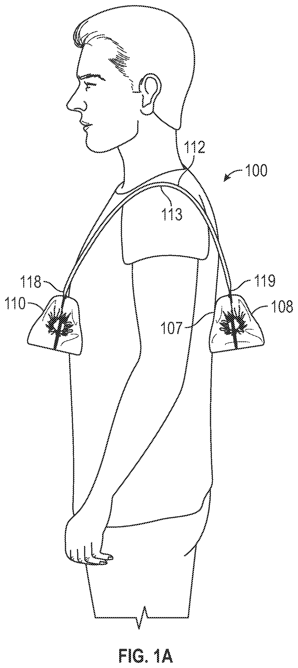 Patent US11771189 Figure 1 – Shoe tote