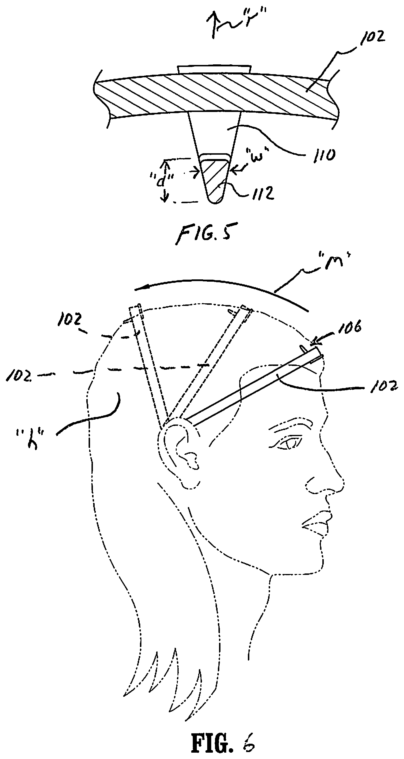 Patent US11771194 Figure 3 – Hair band apparatus