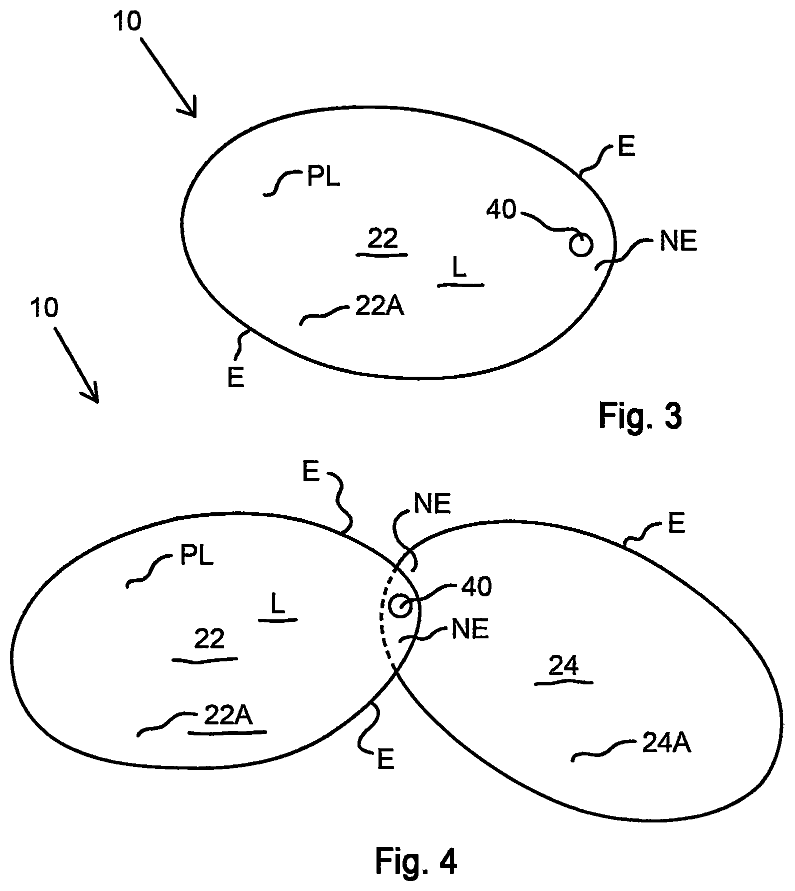 Patent US11771233 Figure 2 – Pivotably deployable knee-cushion assembly for home indoor and outdoor usage