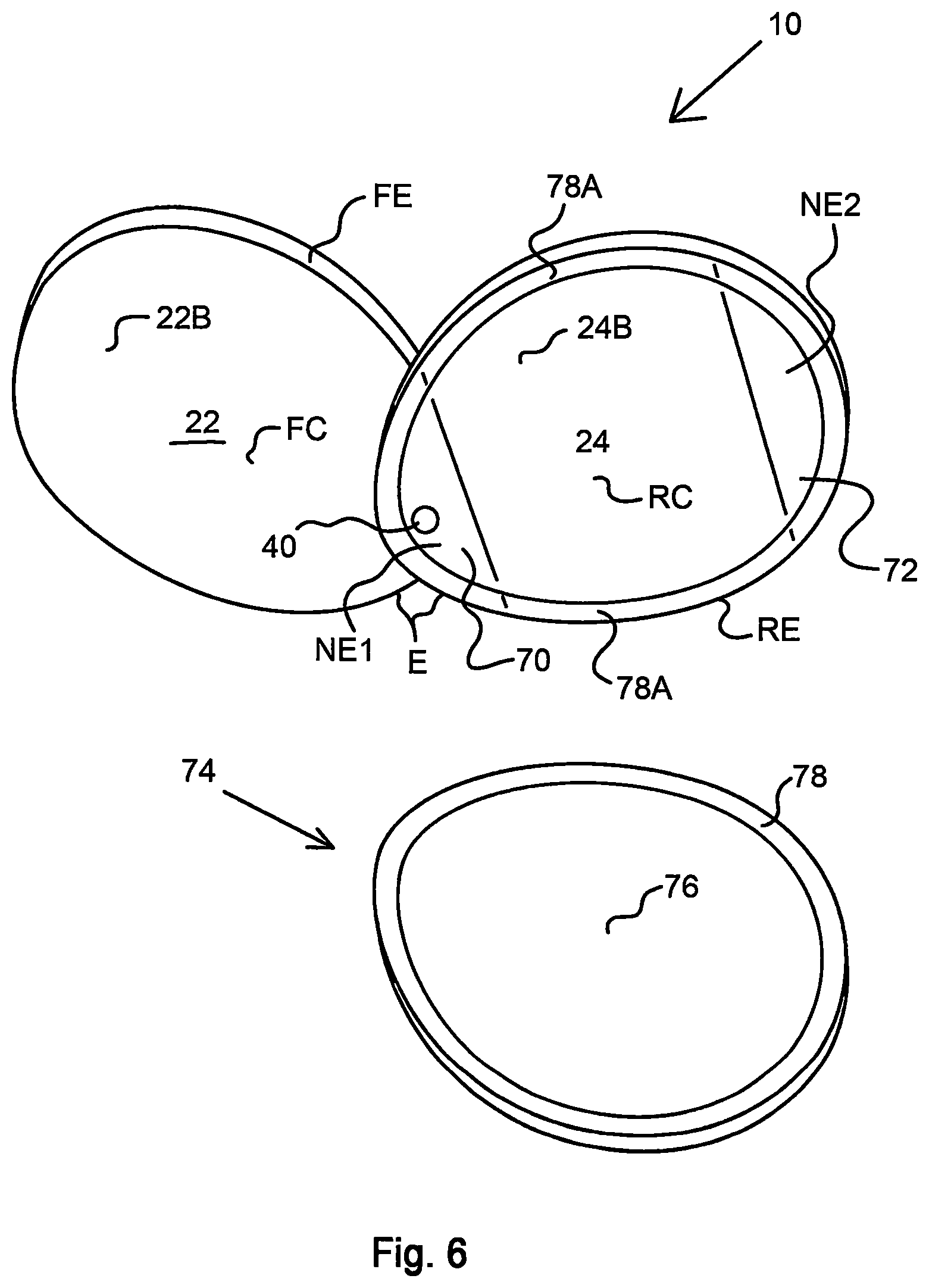 Patent US11771233 Figure 4 – Pivotably deployable knee-cushion assembly for home indoor and outdoor usage