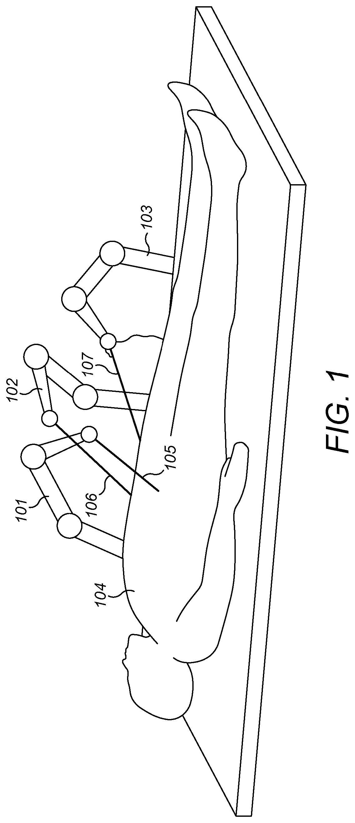 Patent US11771302 Figure 1 – Image correction of a surgical endoscope video stream
