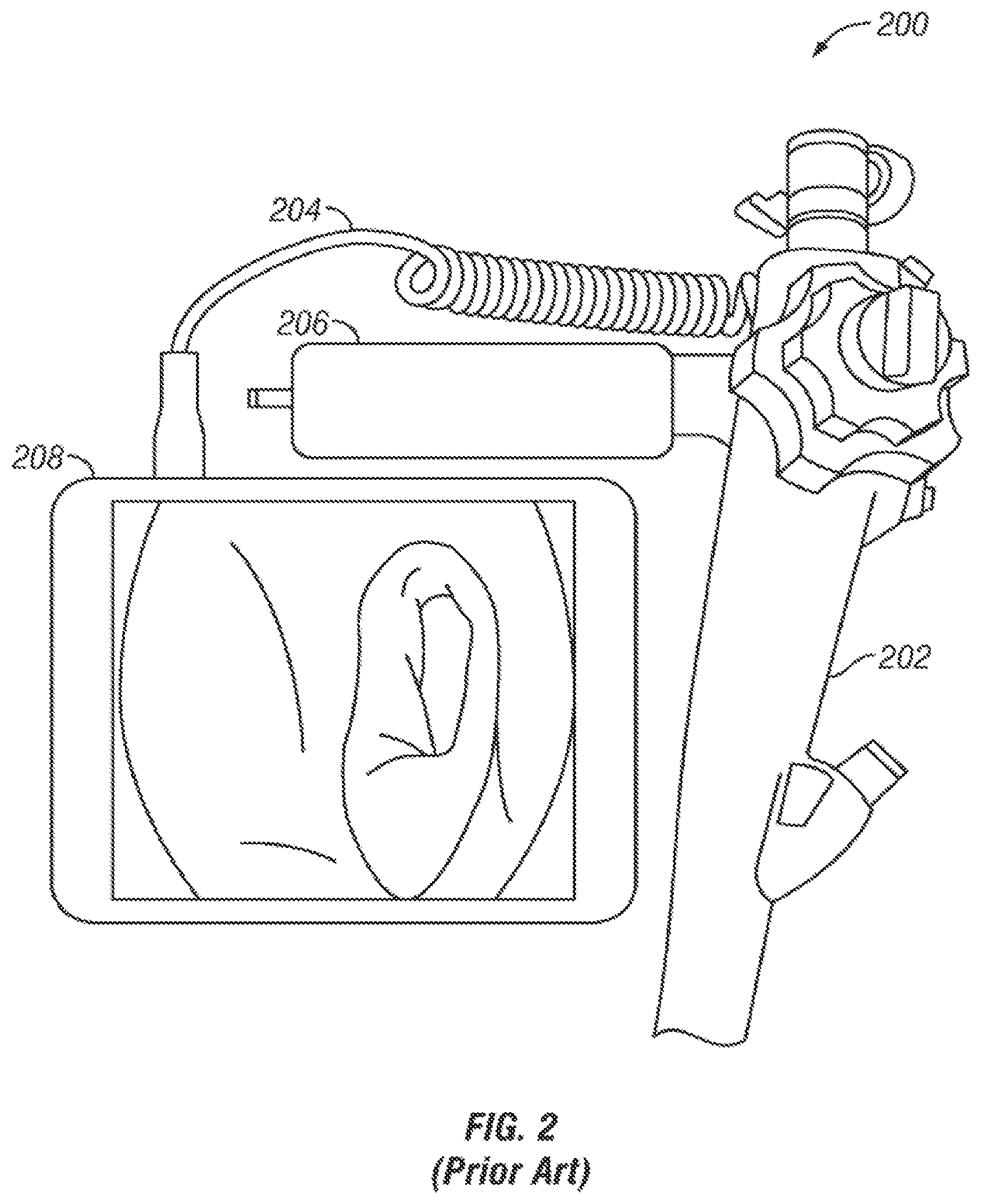 Patent US11771303 Figure 2 – System and method for wirelessly transmitting operational data from an endoscope to a remote device
