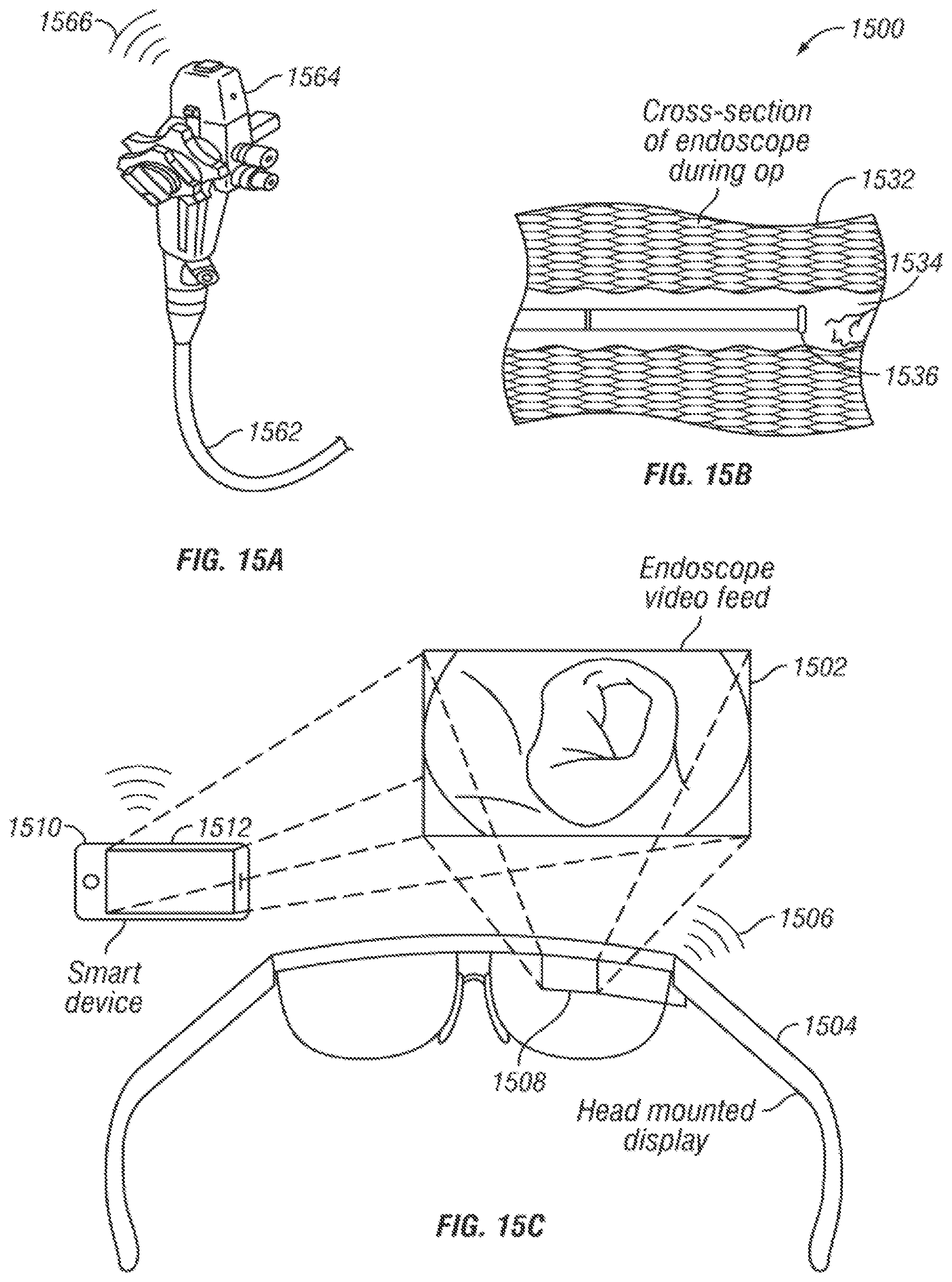 Patent US11771303 Figure 13 – System and method for wirelessly transmitting operational data from an endoscope to a remote device