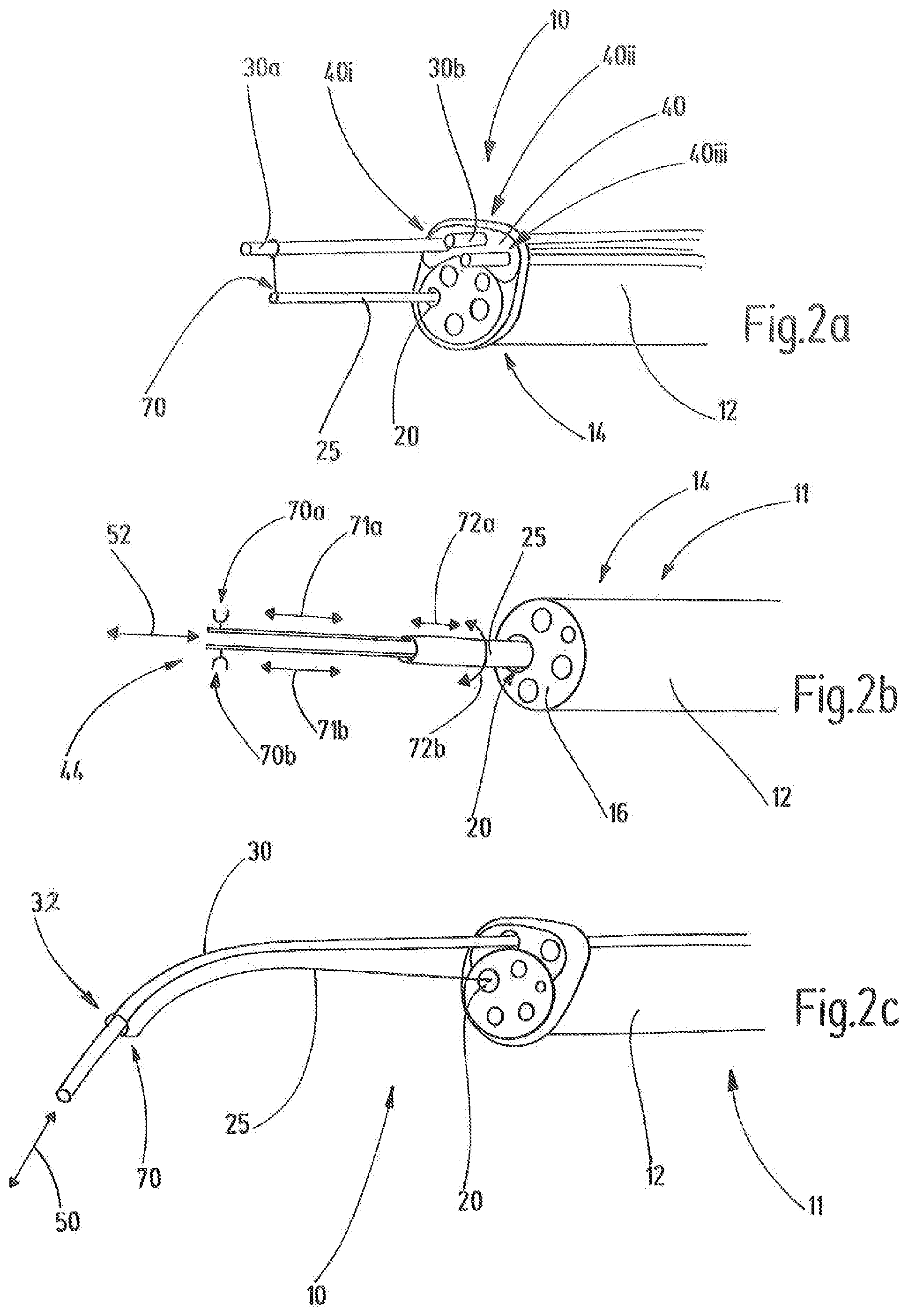Patent US11771305 Figure 4 – Device with a working channel guiding element
