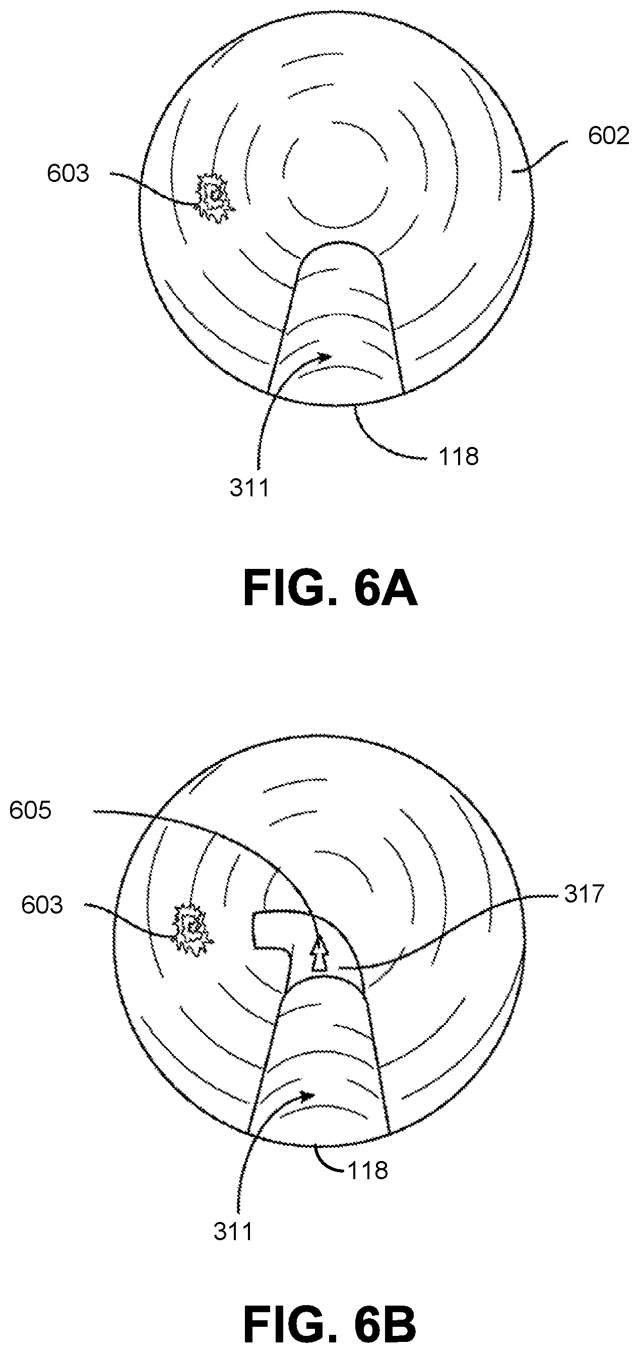 Patent US11771309 Figure 17 – Detecting endolumenal buckling of flexible instruments