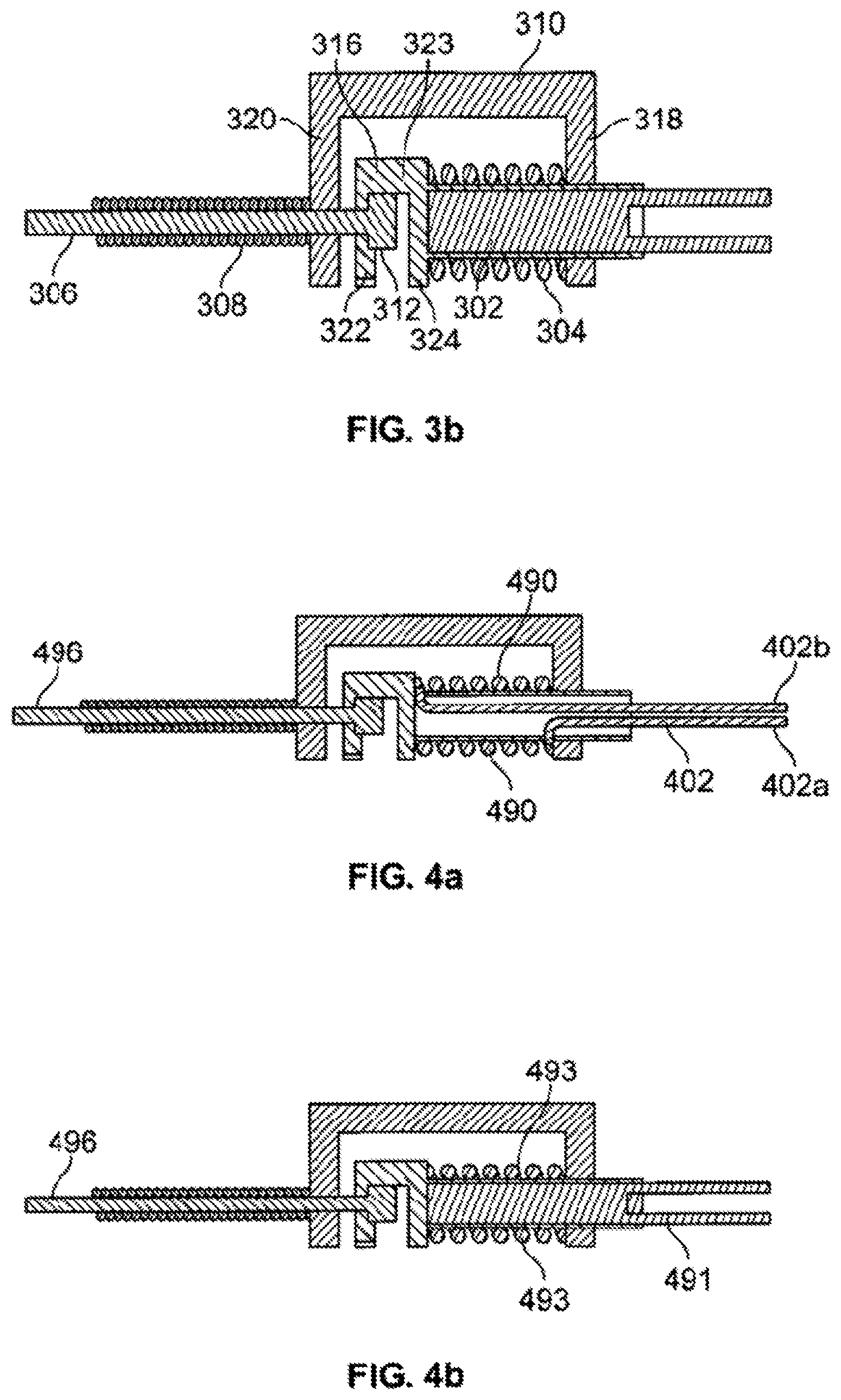 Patent US11771310 Figure 4 – Systems and methods for varying stiffness of an endoscopic insertion tube