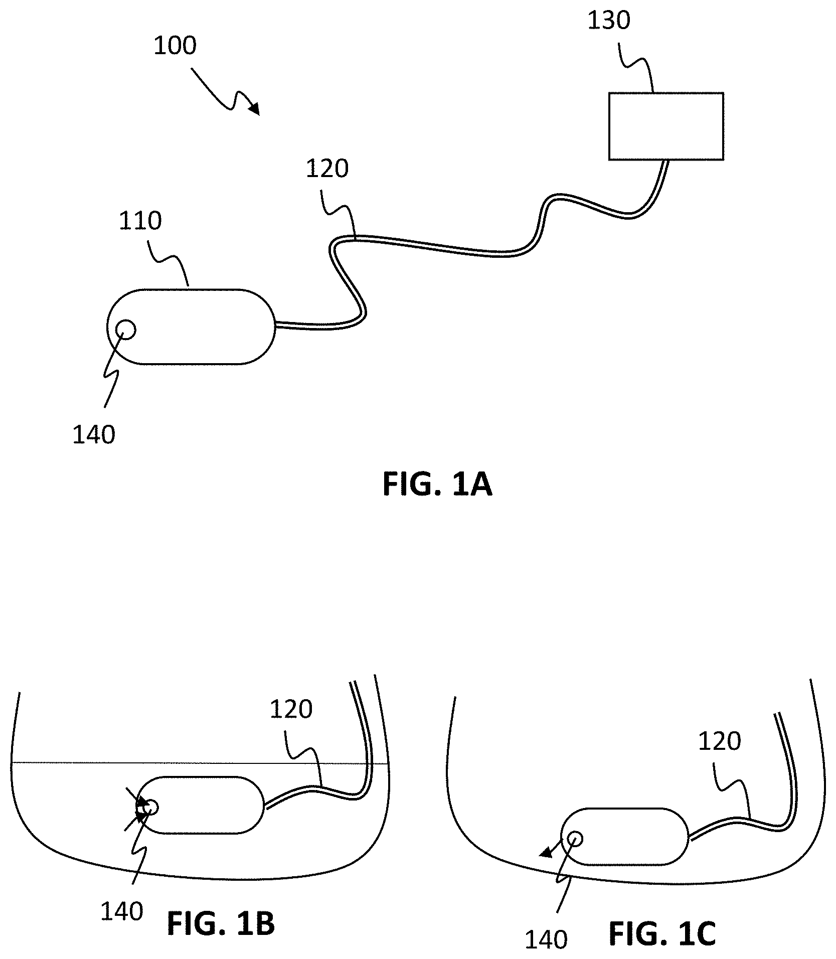 Patent US11771311 — Systems and methods for collecting and screening of pancreatic secretions — Figure 1
