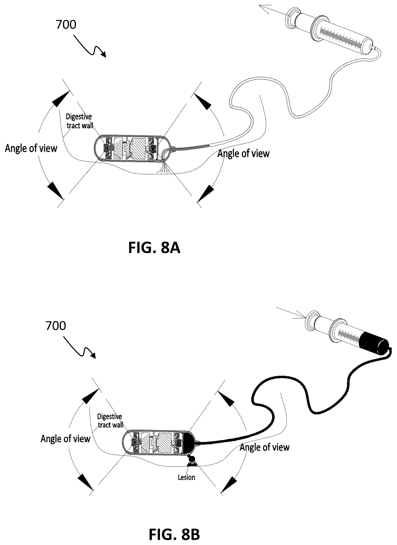 Patent US11771311 Figure 8 – Systems and methods for collecting and screening of pancreatic secretions
