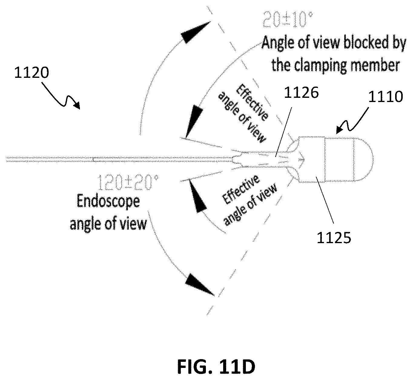 Patent US11771311 Figure 12 – Systems and methods for collecting and screening of pancreatic secretions