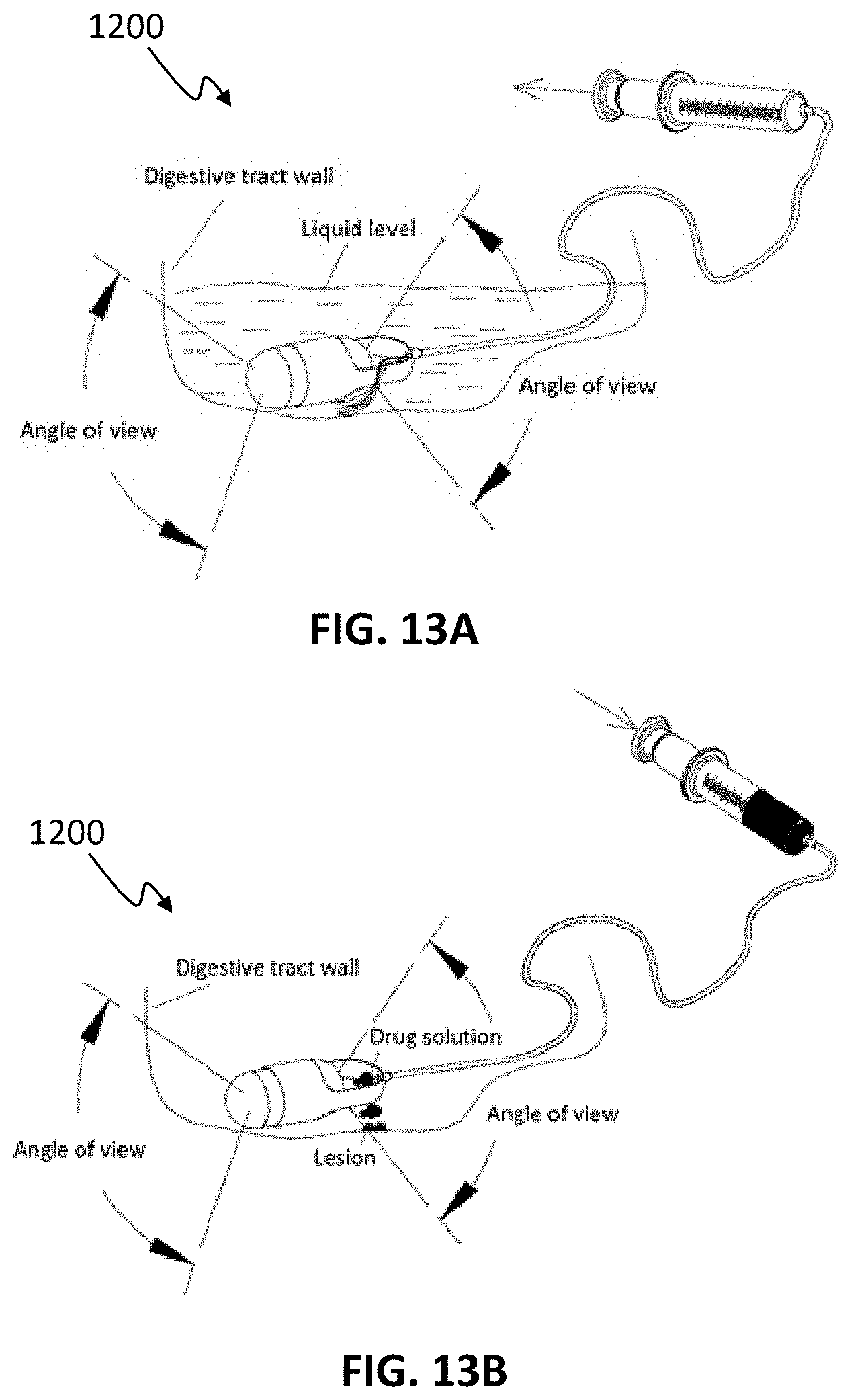 Patent US11771311 Figure 15 – Systems and methods for collecting and screening of pancreatic secretions