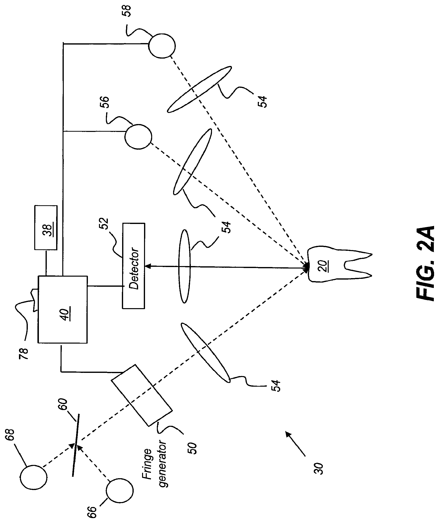 Patent US11771313 Figure 2 – Intra-oral 3-D fluorescence imaging