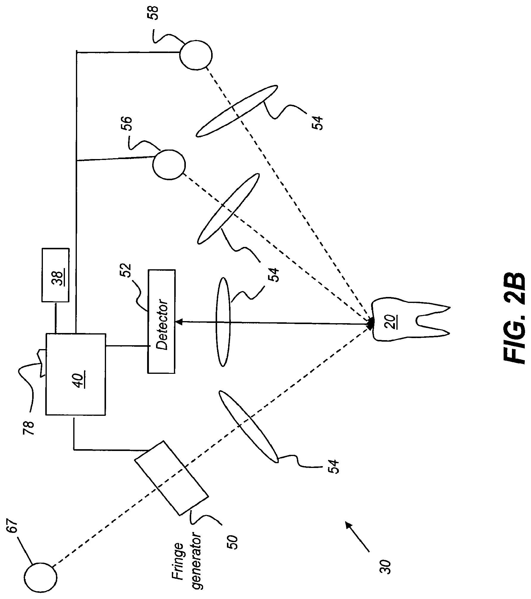 Patent US11771313 Figure 3 – Intra-oral 3-D fluorescence imaging