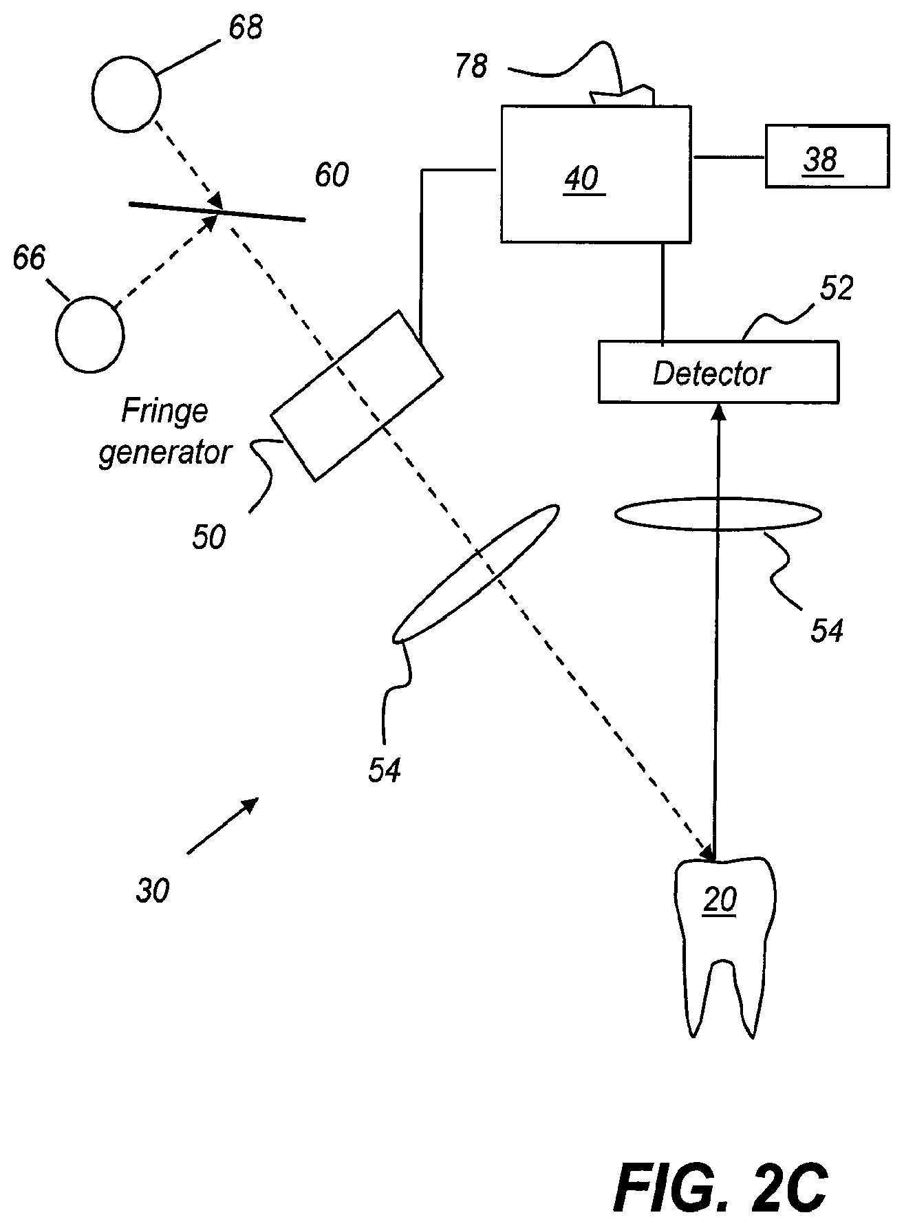Patent US11771313 Figure 4 – Intra-oral 3-D fluorescence imaging