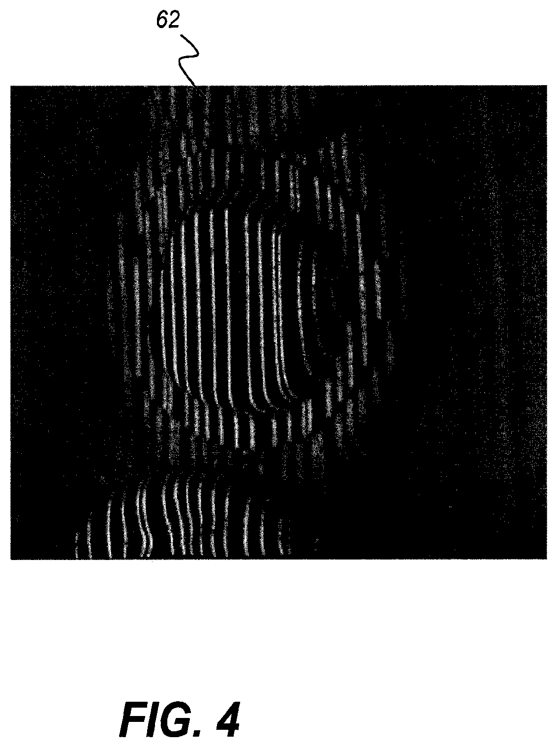 Patent US11771313 Figure 6 – Intra-oral 3-D fluorescence imaging