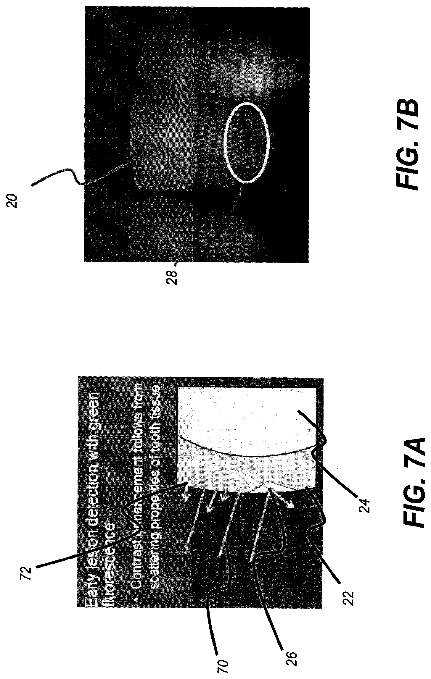 Patent US11771313 Figure 9 – Intra-oral 3-D fluorescence imaging