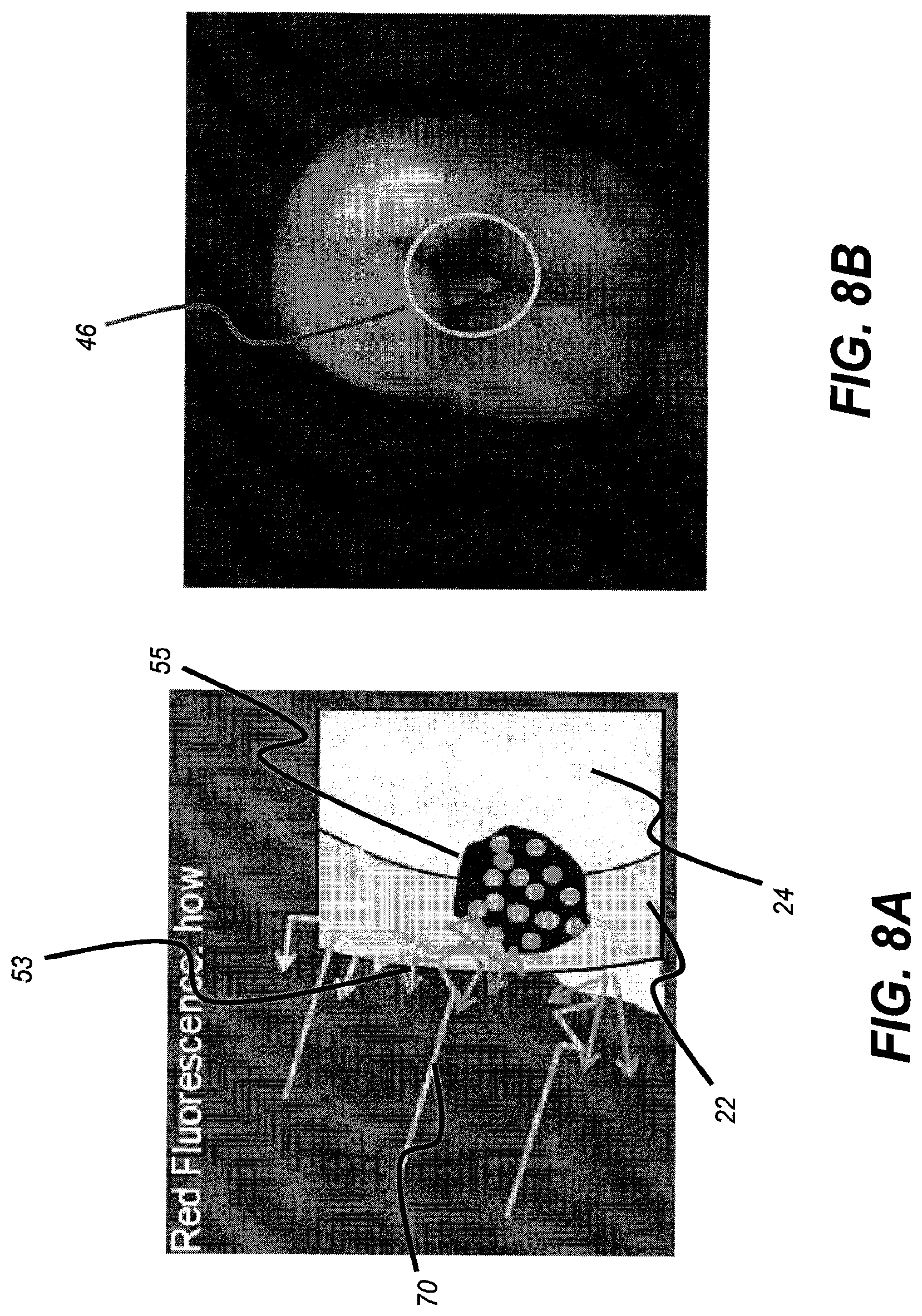 Patent US11771313 Figure 10 – Intra-oral 3-D fluorescence imaging