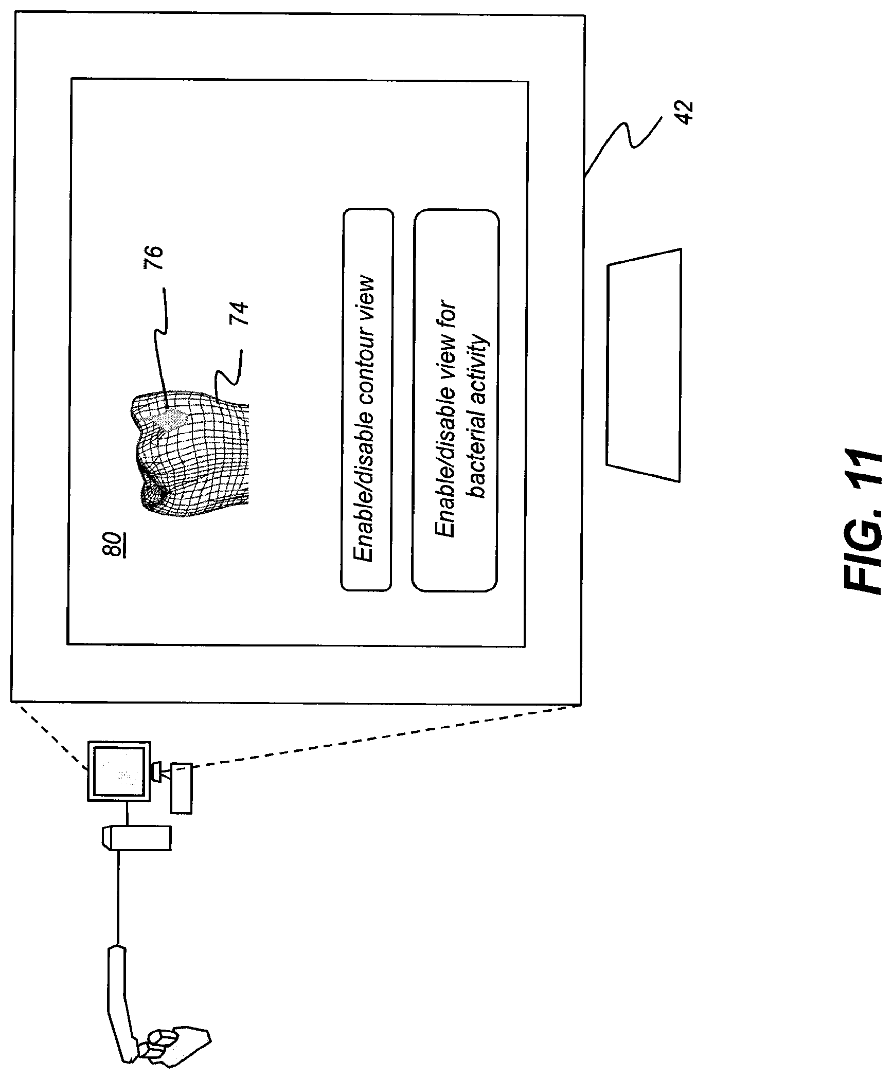 Patent US11771313 Figure 13 – Intra-oral 3-D fluorescence imaging