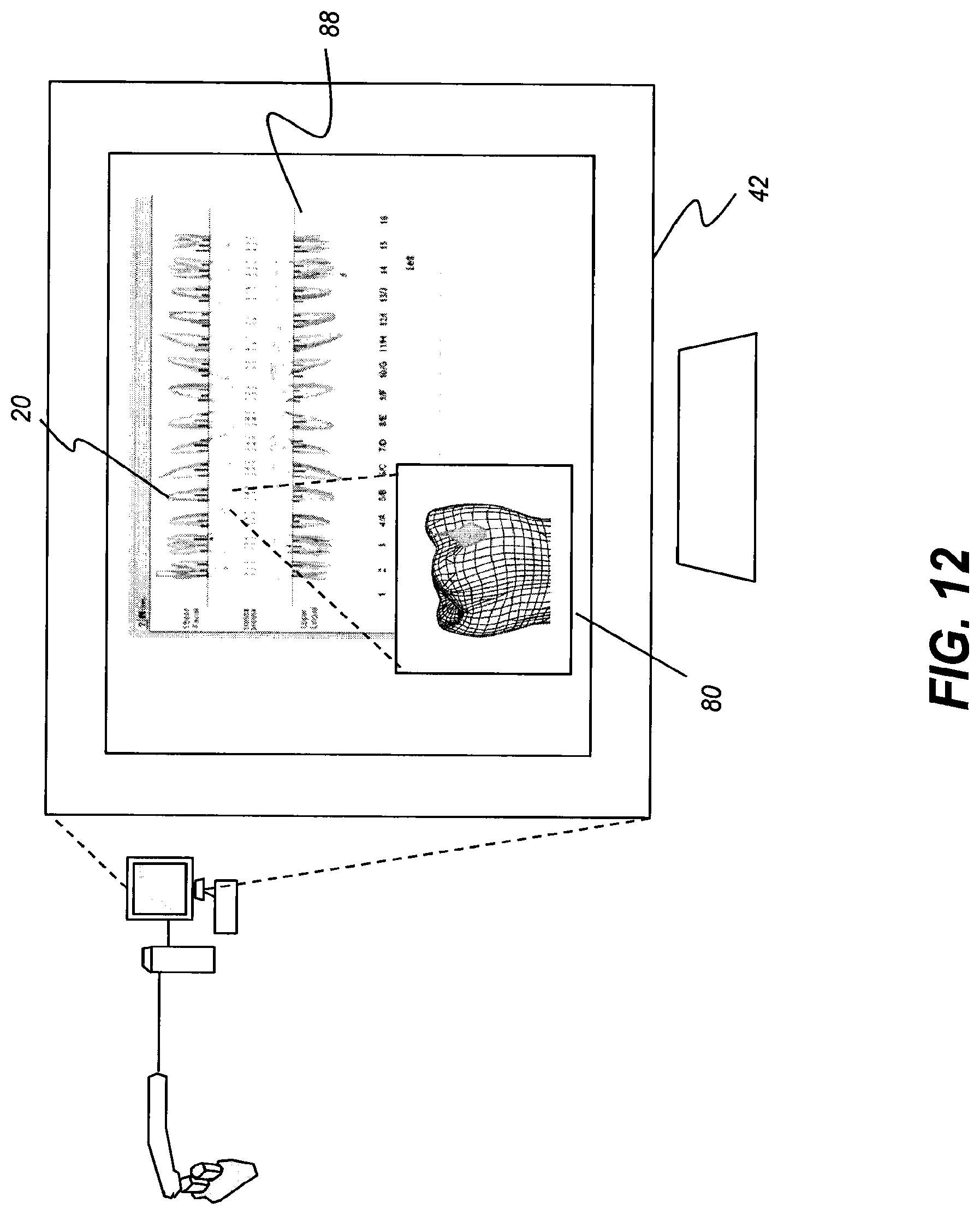 Patent US11771313 Figure 14 – Intra-oral 3-D fluorescence imaging