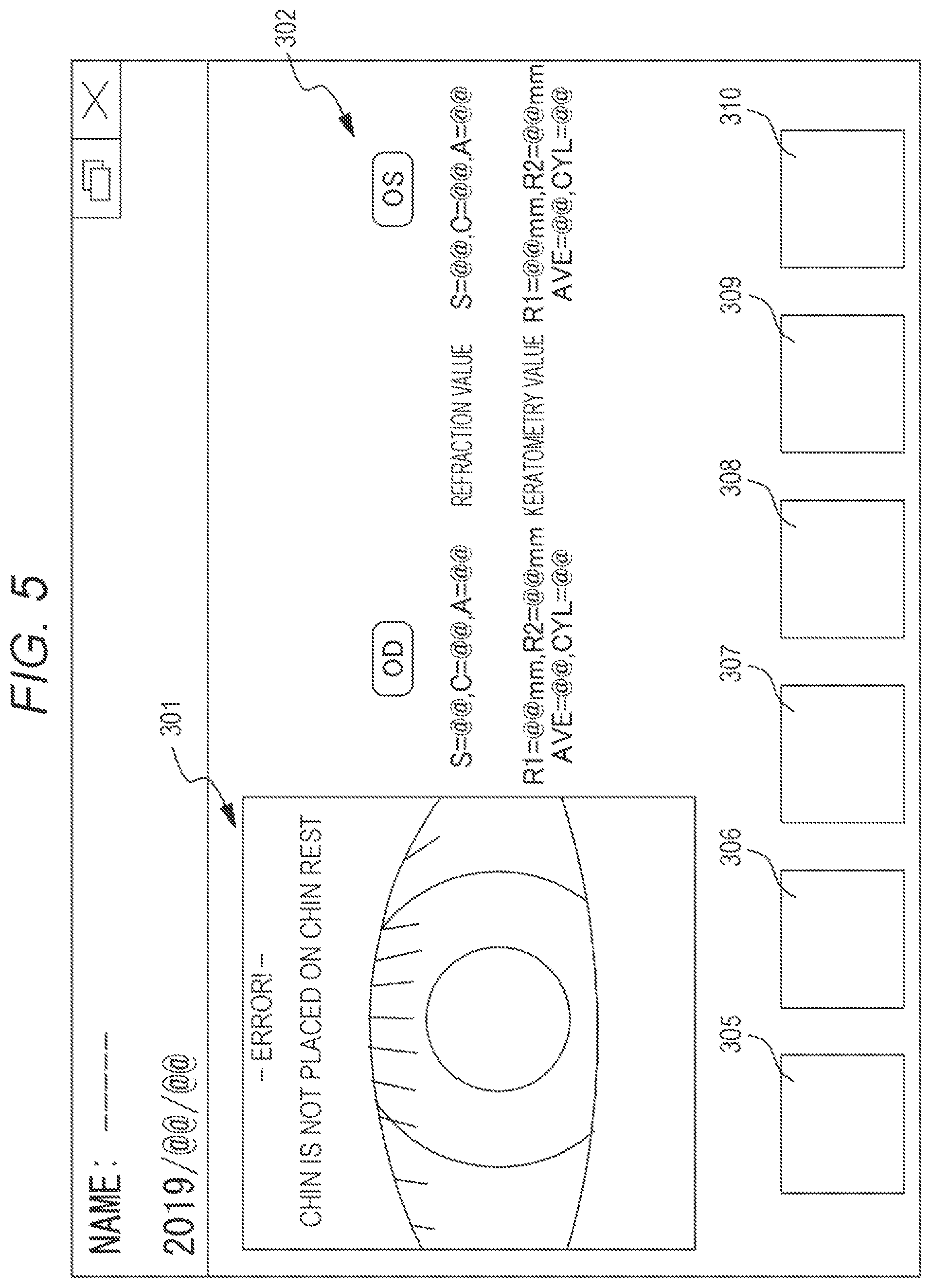 Patent US11771316 Figure 5 – Method for ophthalmic examination and remote examination program