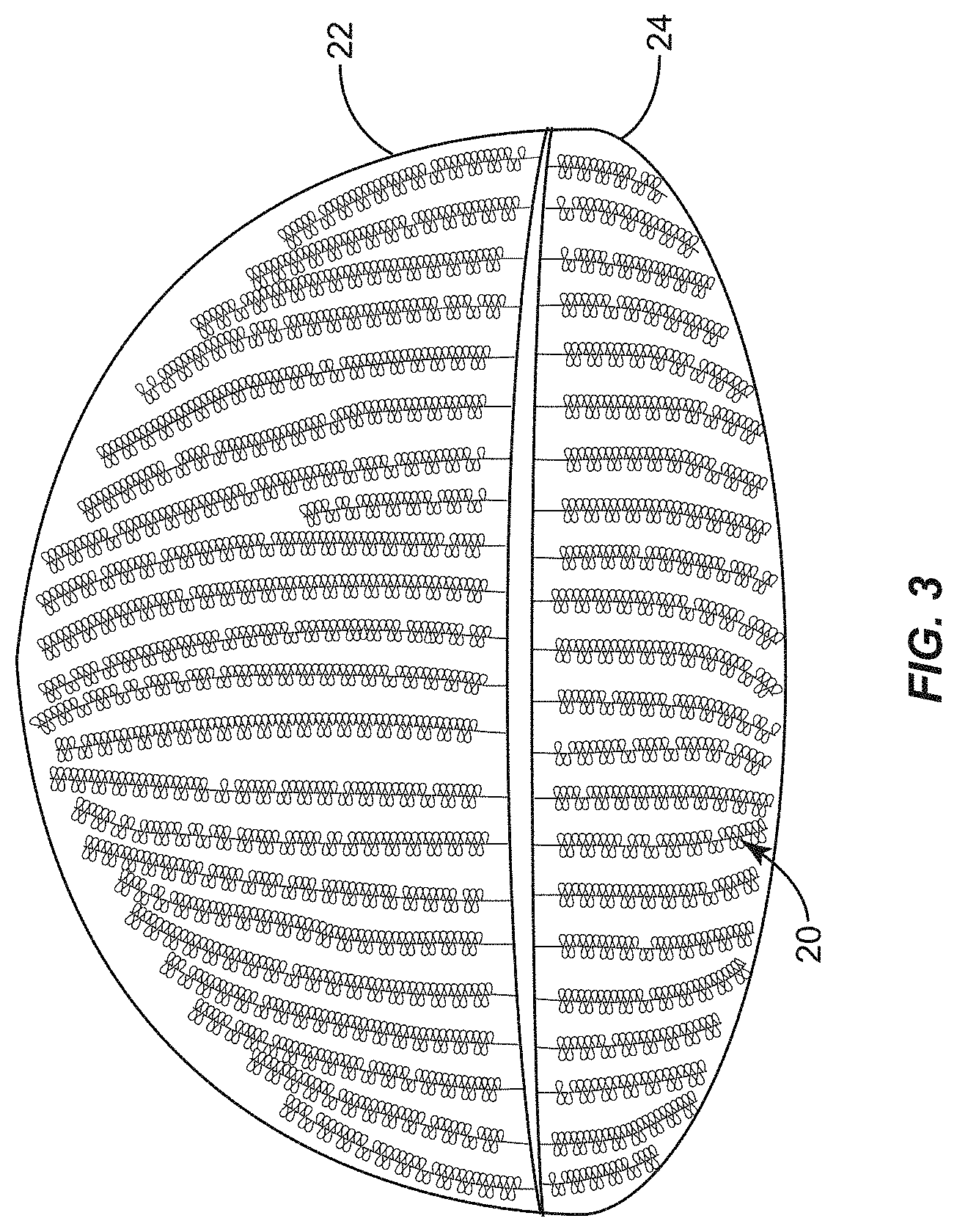 Patent US11771317 Figure 2 – Ocular surface interferometry (OSI) for imaging, processing, and/or displaying an ocular tear film