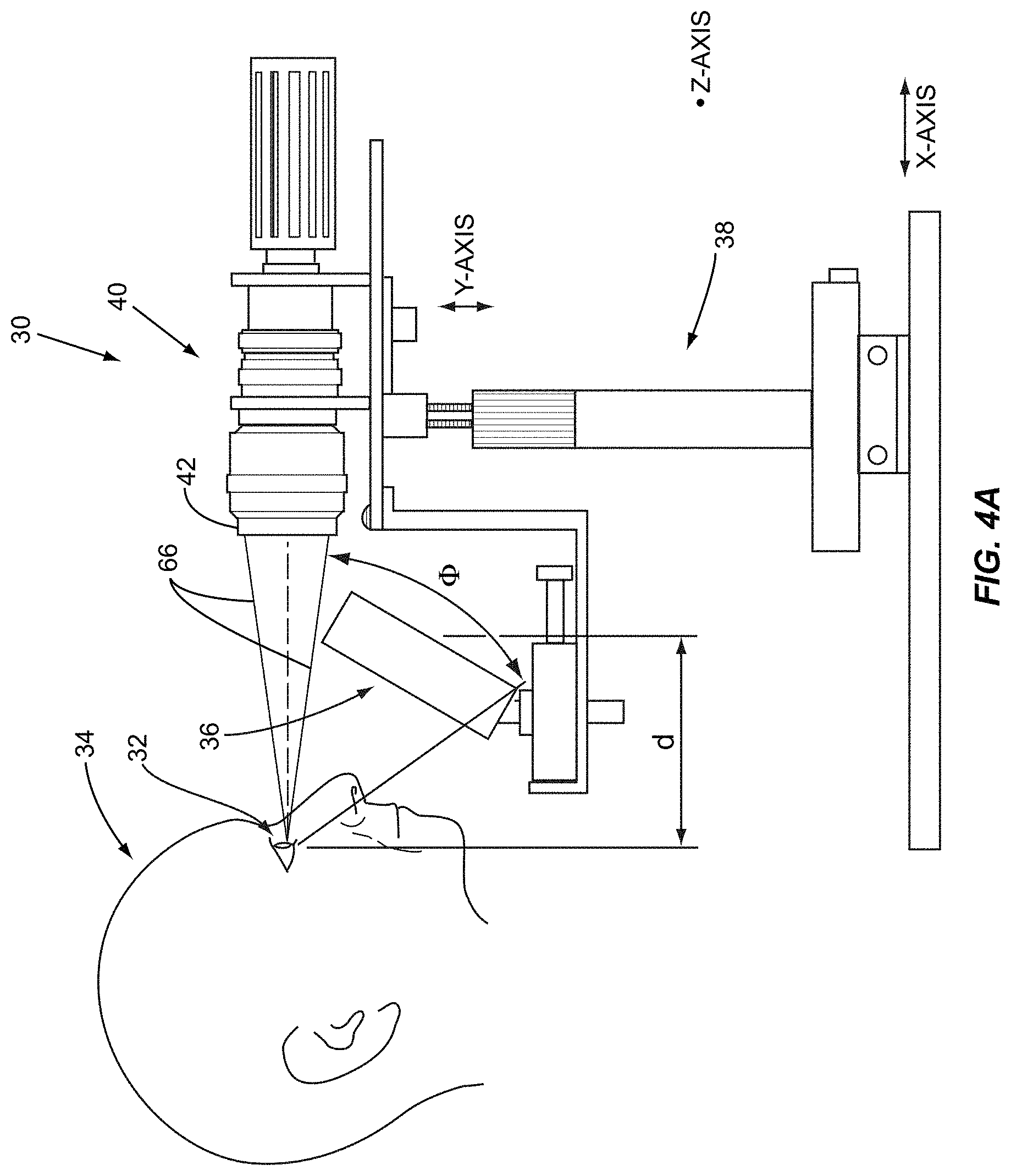 Patent US11771317 Figure 3 – Ocular surface interferometry (OSI) for imaging, processing, and/or displaying an ocular tear film