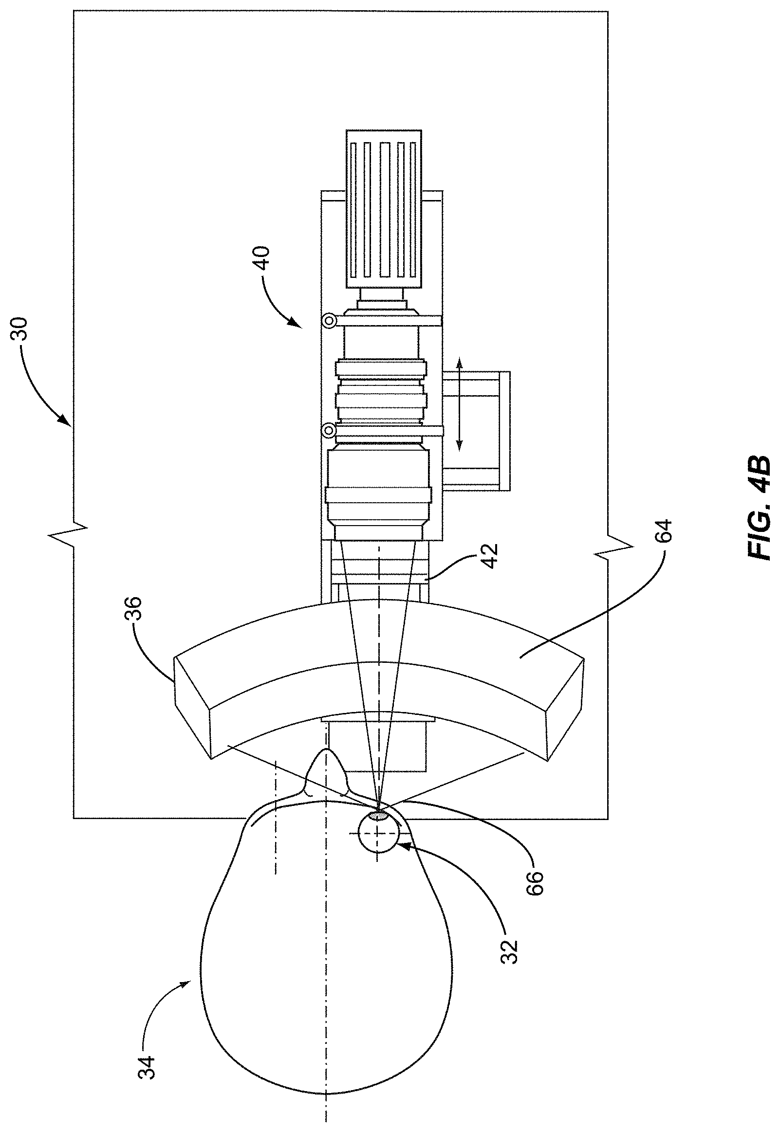Patent US11771317 Figure 4 – Ocular surface interferometry (OSI) for imaging, processing, and/or displaying an ocular tear film