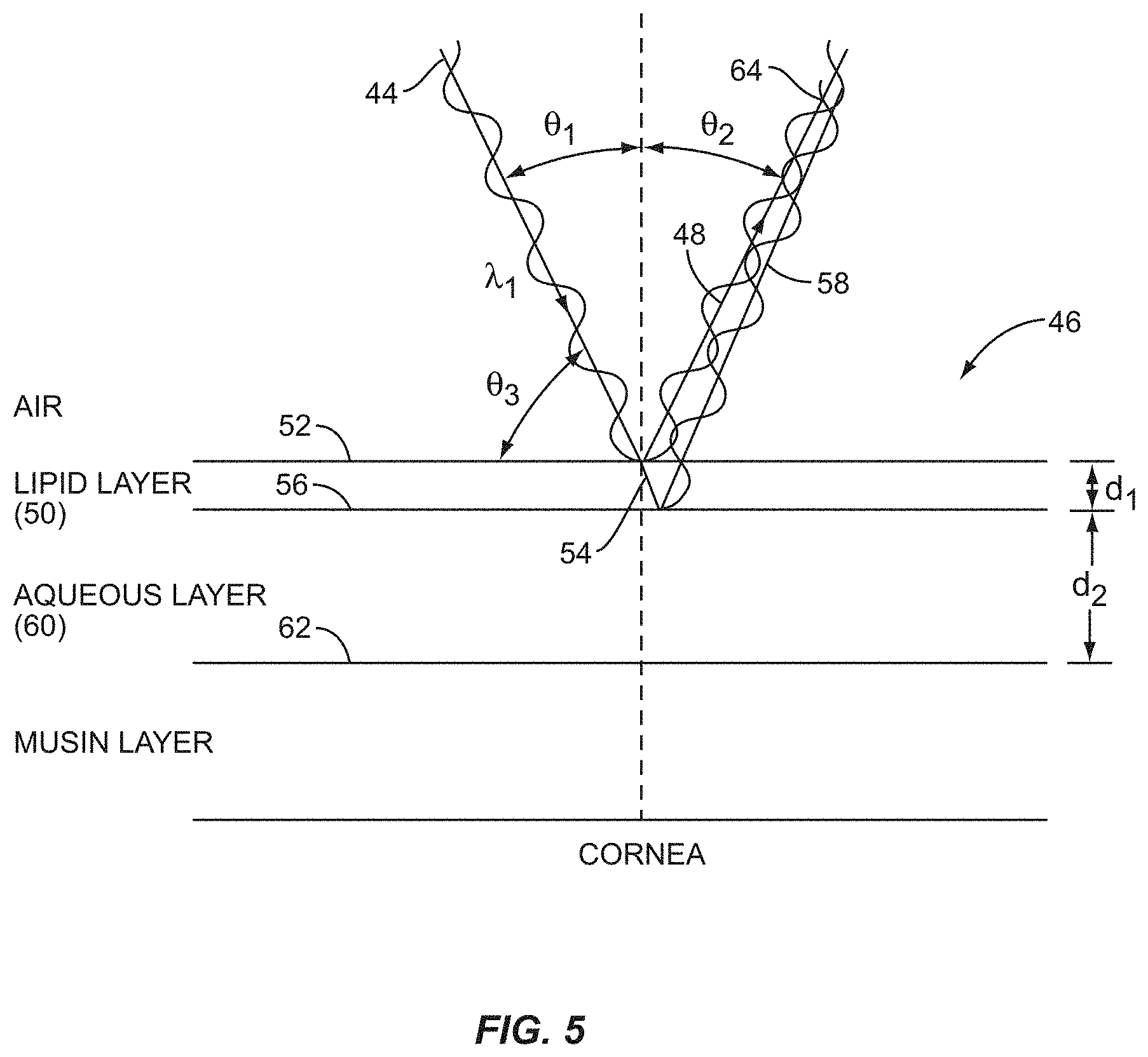 Patent US11771317 Figure 5 – Ocular surface interferometry (OSI) for imaging, processing, and/or displaying an ocular tear film