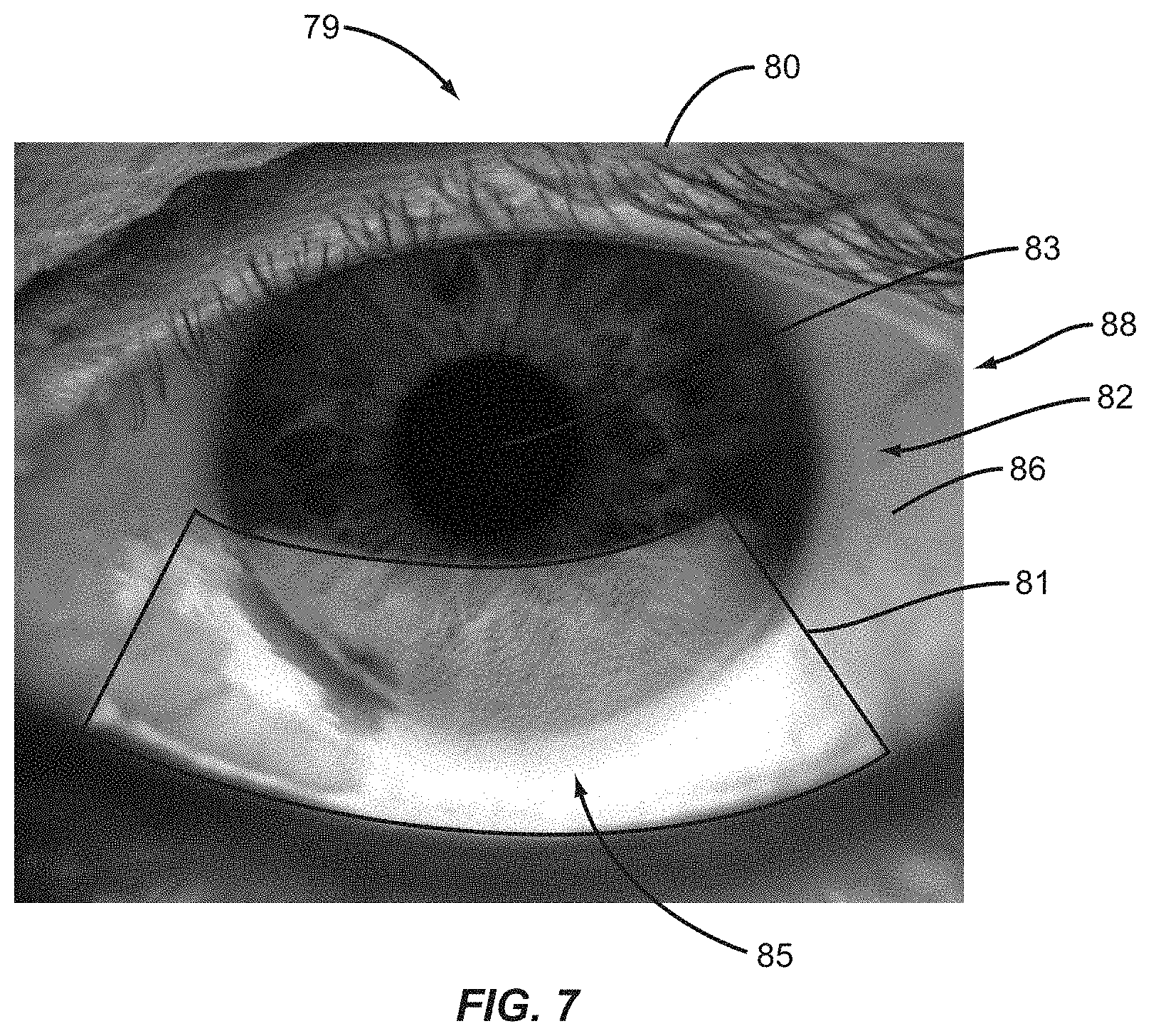 Patent US11771317 Figure 7 – Ocular surface interferometry (OSI) for imaging, processing, and/or displaying an ocular tear film