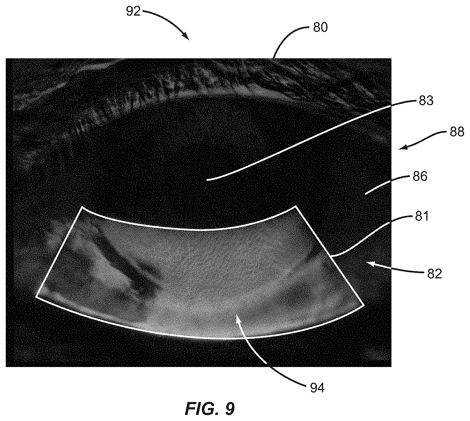 Patent US11771317 Figure 9 – Ocular surface interferometry (OSI) for imaging, processing, and/or displaying an ocular tear film