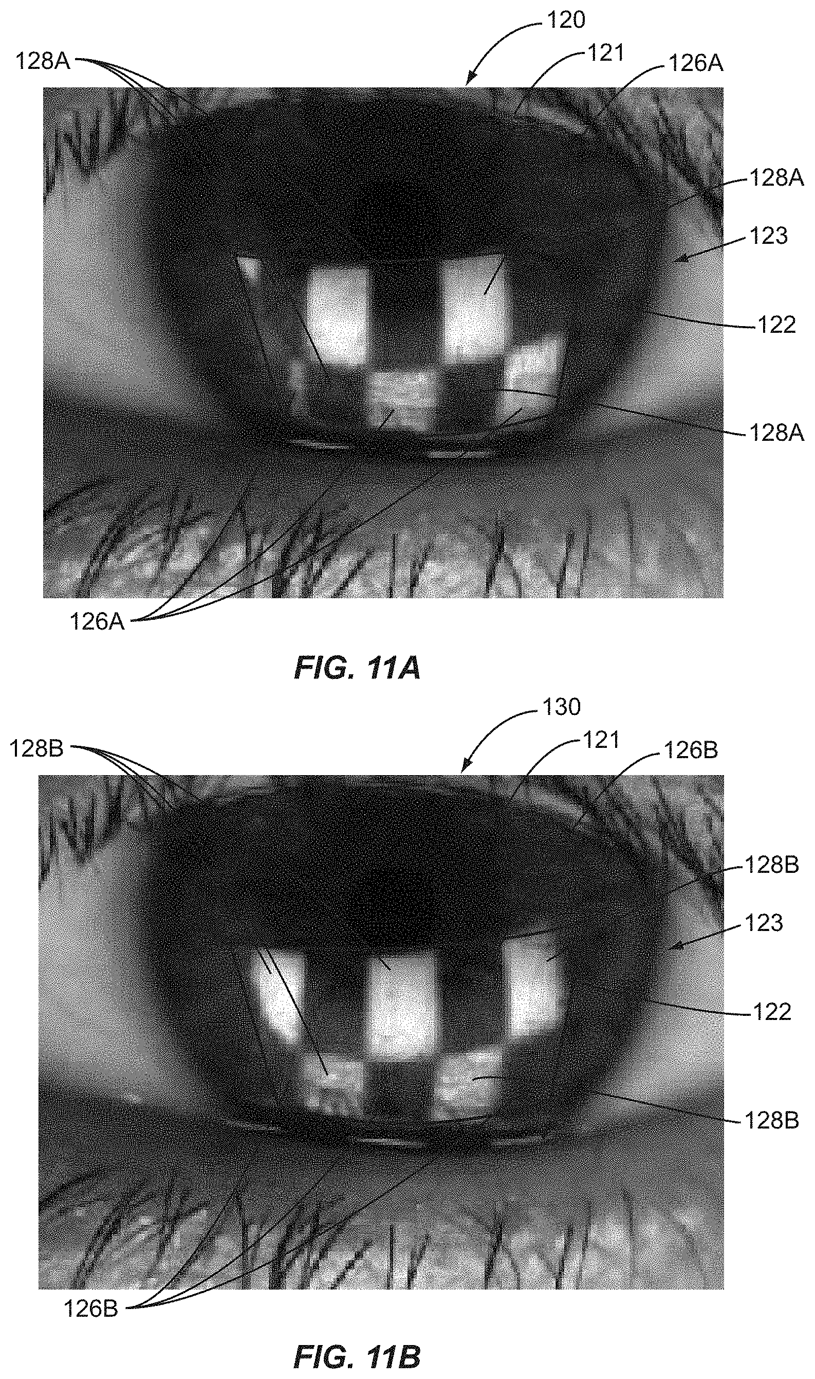 Patent US11771317 Figure 11 – Ocular surface interferometry (OSI) for imaging, processing, and/or displaying an ocular tear film