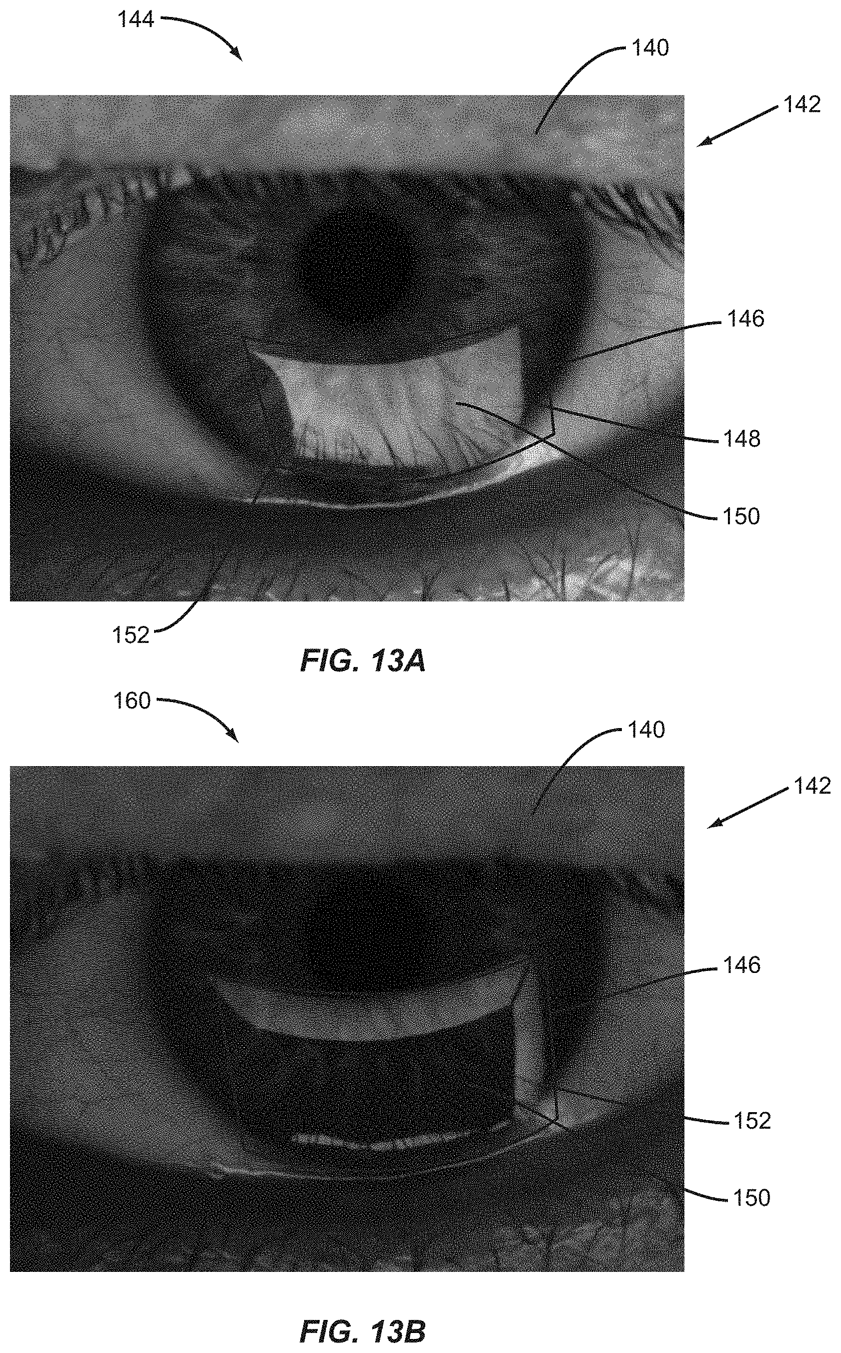 Patent US11771317 Figure 13 – Ocular surface interferometry (OSI) for imaging, processing, and/or displaying an ocular tear film