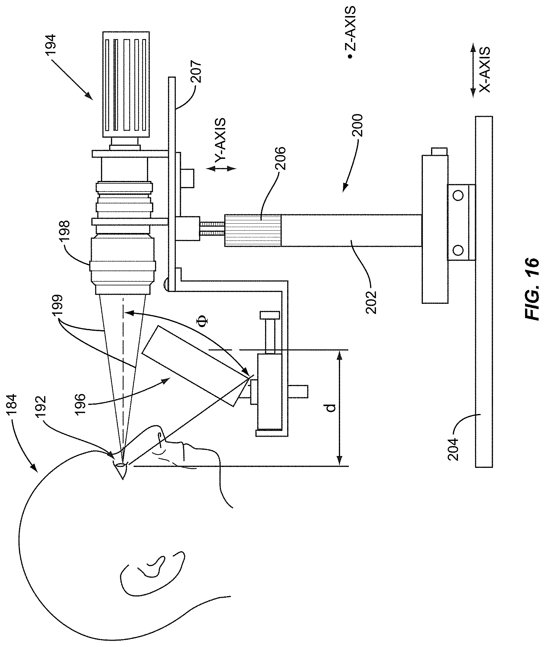 Patent US11771317 Figure 16 – Ocular surface interferometry (OSI) for imaging, processing, and/or displaying an ocular tear film