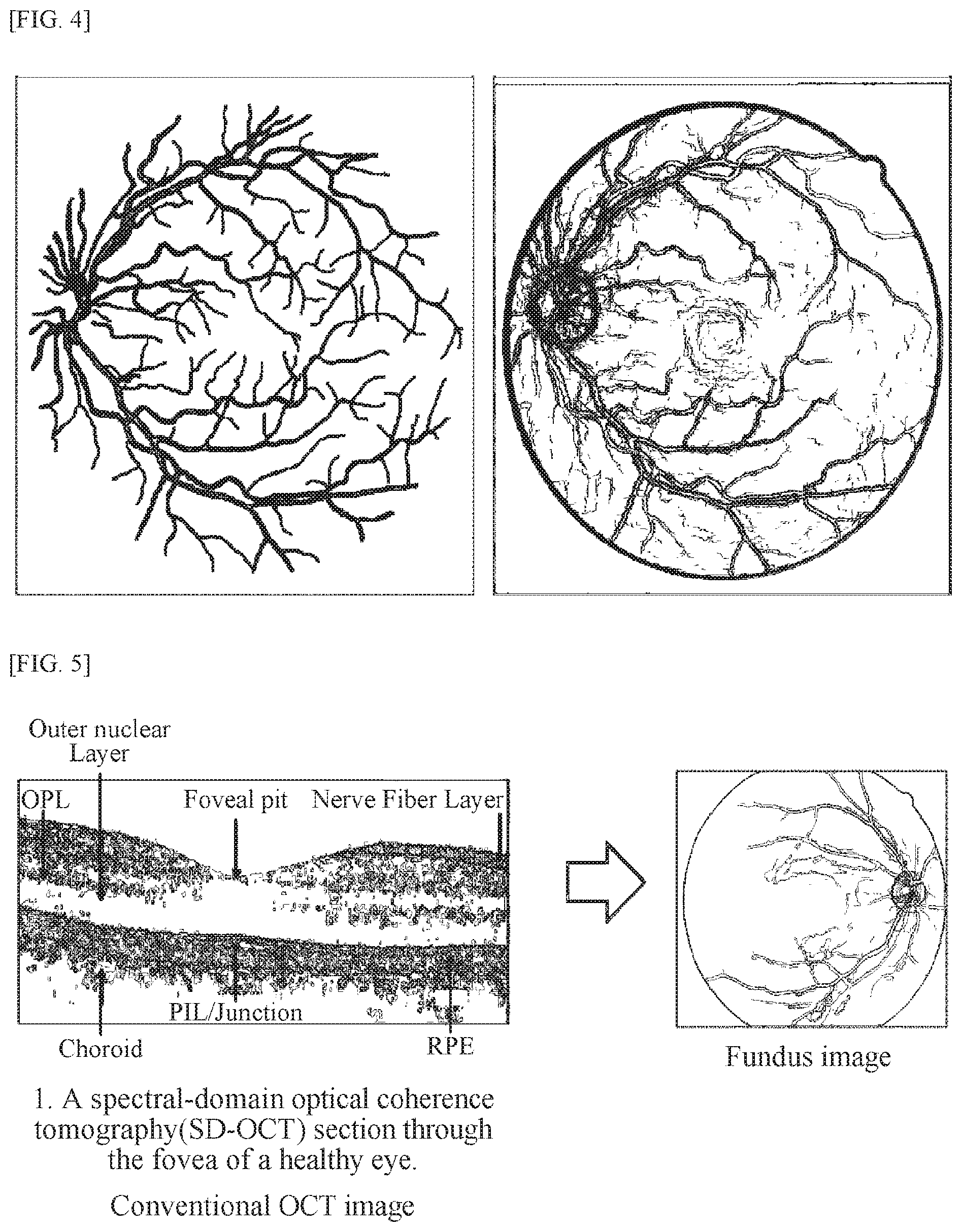 Patent US11771318 Figure 3 – Method for supporting reading of fundus image of subject, and device using same