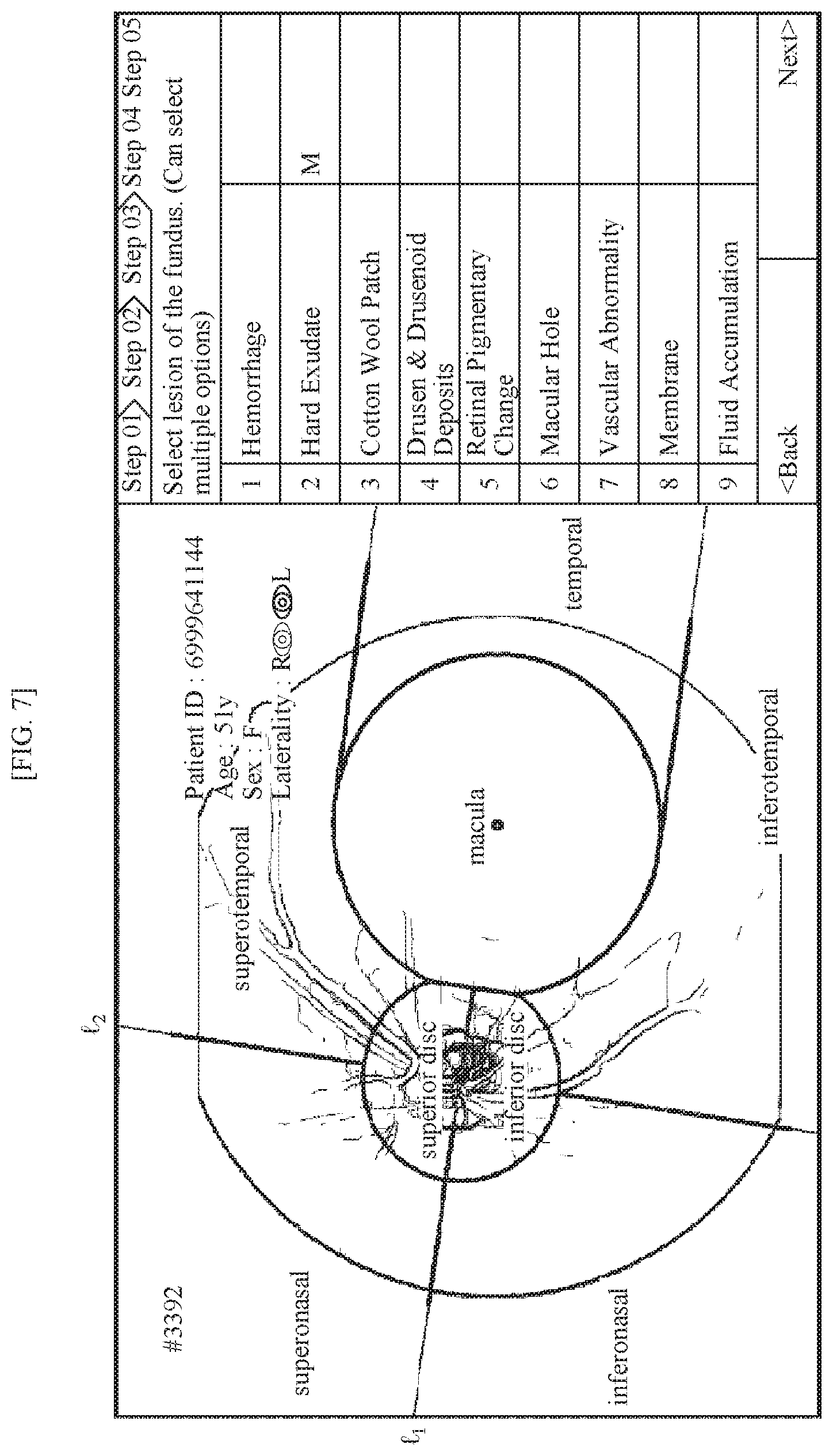 Patent US11771318 Figure 5 – Method for supporting reading of fundus image of subject, and device using same