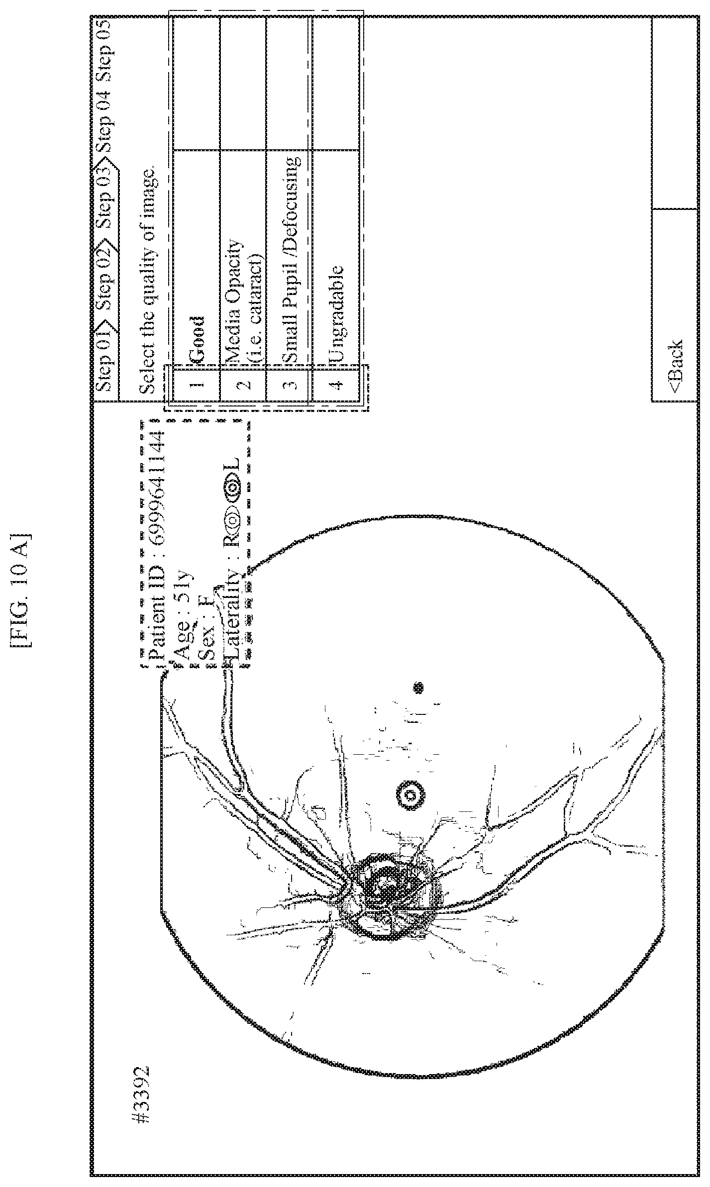 Patent US11771318 Figure 7 – Method for supporting reading of fundus image of subject, and device using same