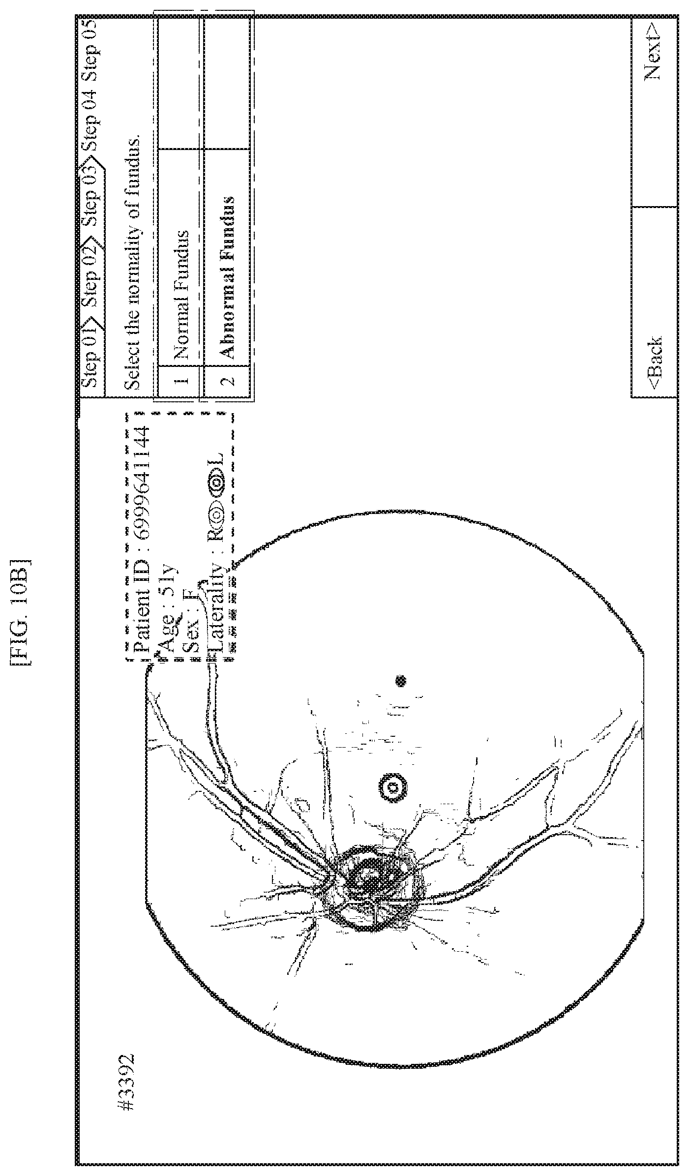 Patent US11771318 Figure 8 – Method for supporting reading of fundus image of subject, and device using same