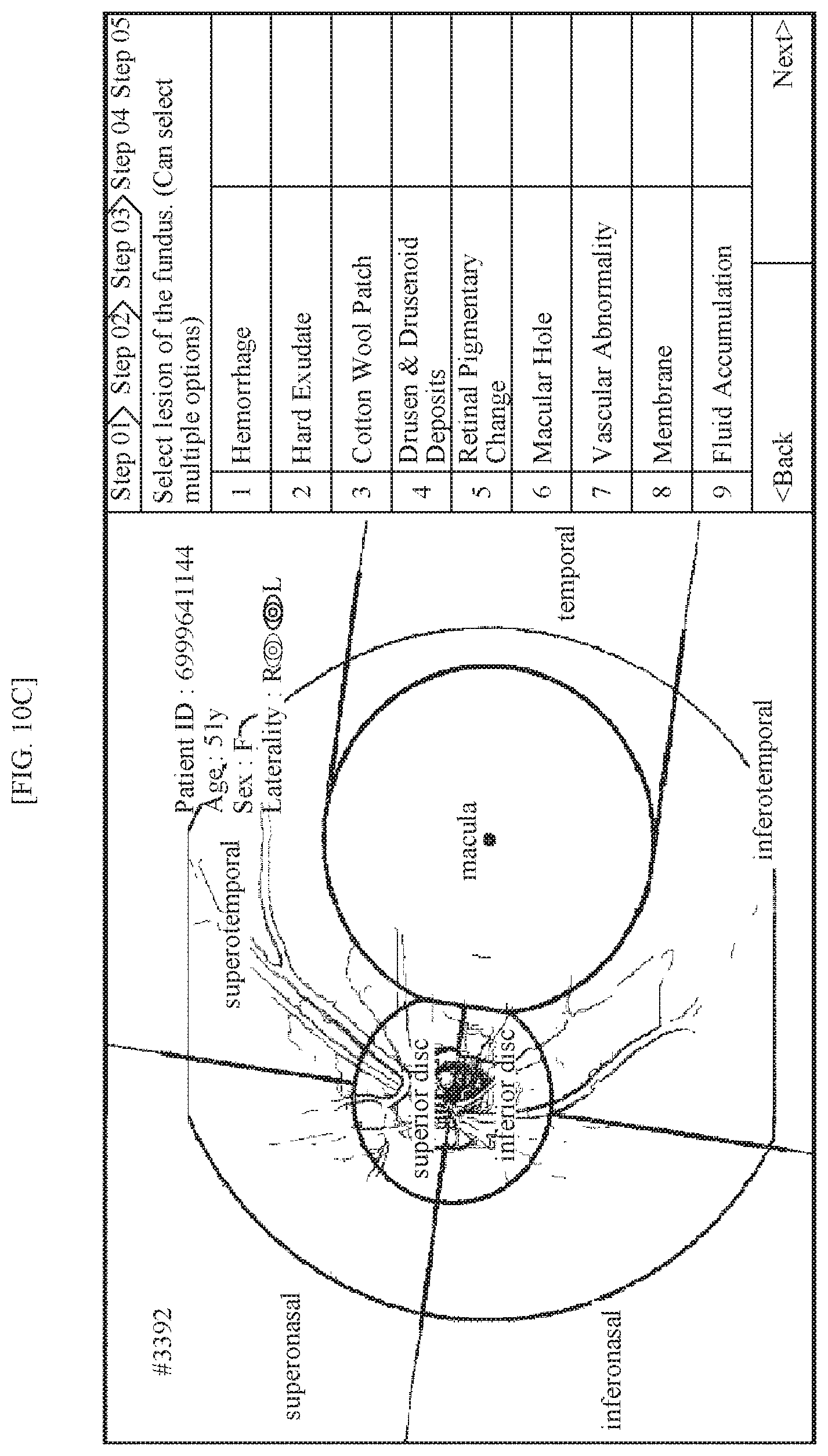 Patent US11771318 Figure 9 – Method for supporting reading of fundus image of subject, and device using same