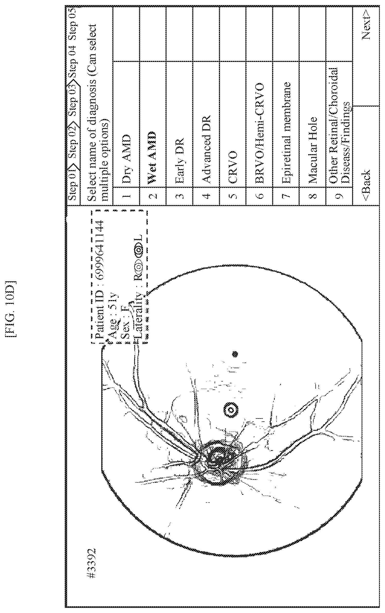 Patent US11771318 Figure 10 – Method for supporting reading of fundus image of subject, and device using same