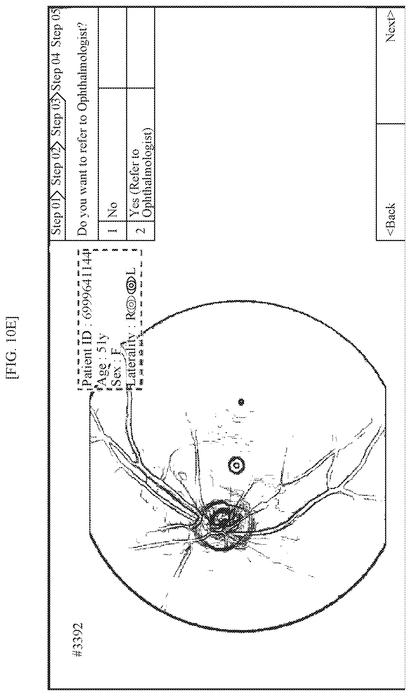 Patent US11771318 Figure 11 – Method for supporting reading of fundus image of subject, and device using same