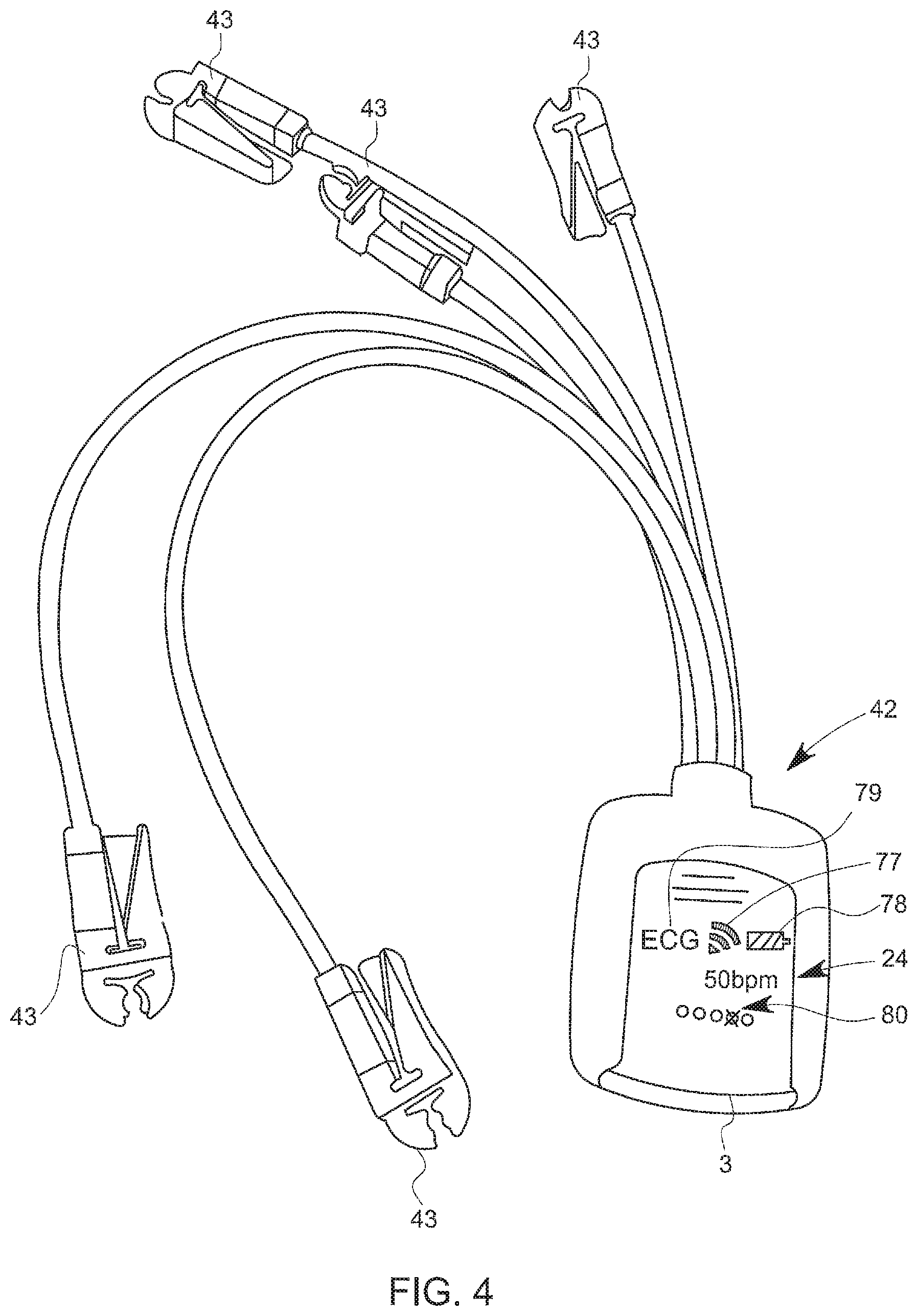 Patent US11771319 Figure 3 – Interface for two-part wearable patient monitoring device