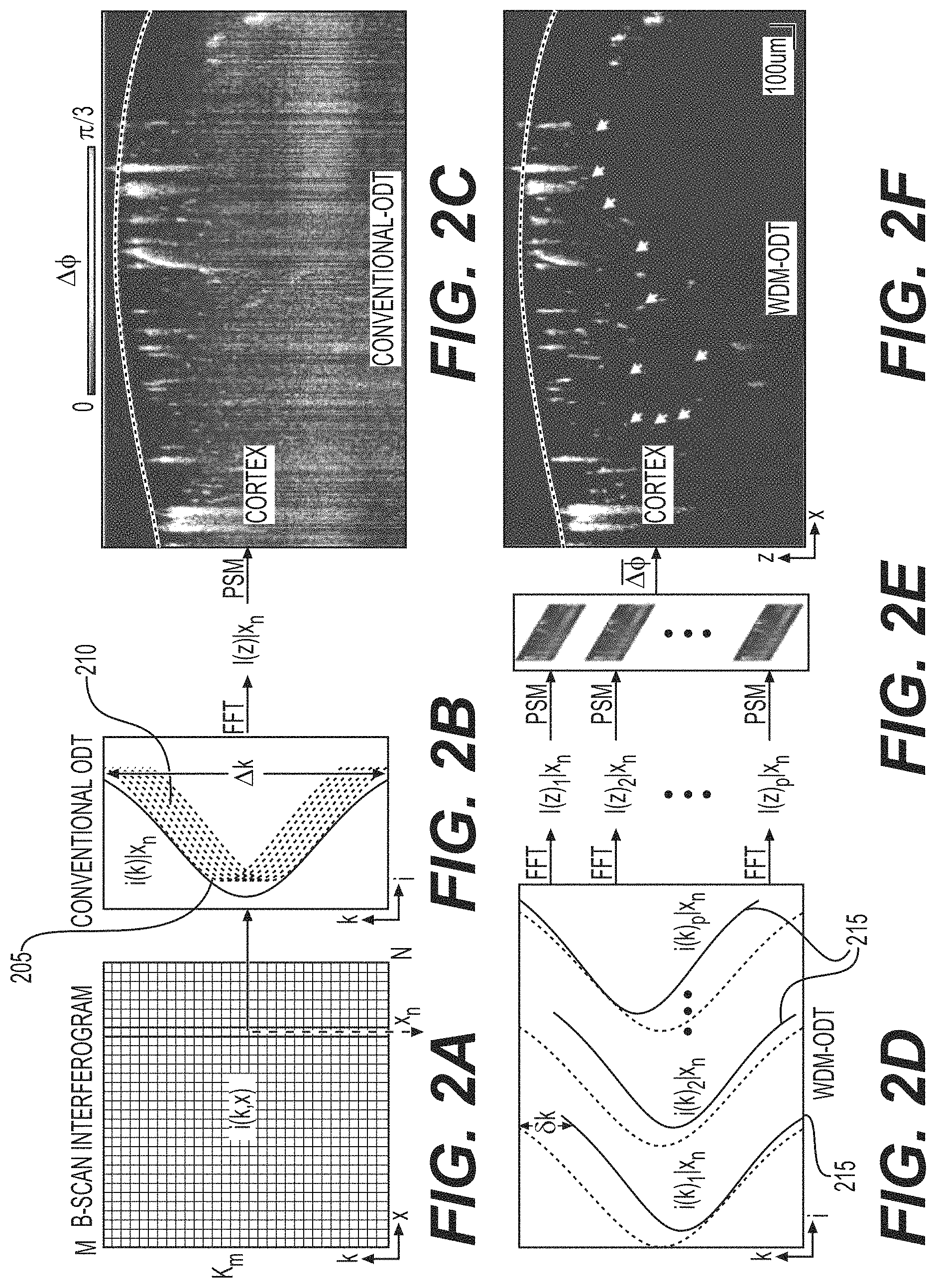 Patent US11771321 Figure 2 – System, method, and computer-accessible medium for subsurface capillary flow imaging by wavelength-division-multiplexing swept-source optical doppler tomography