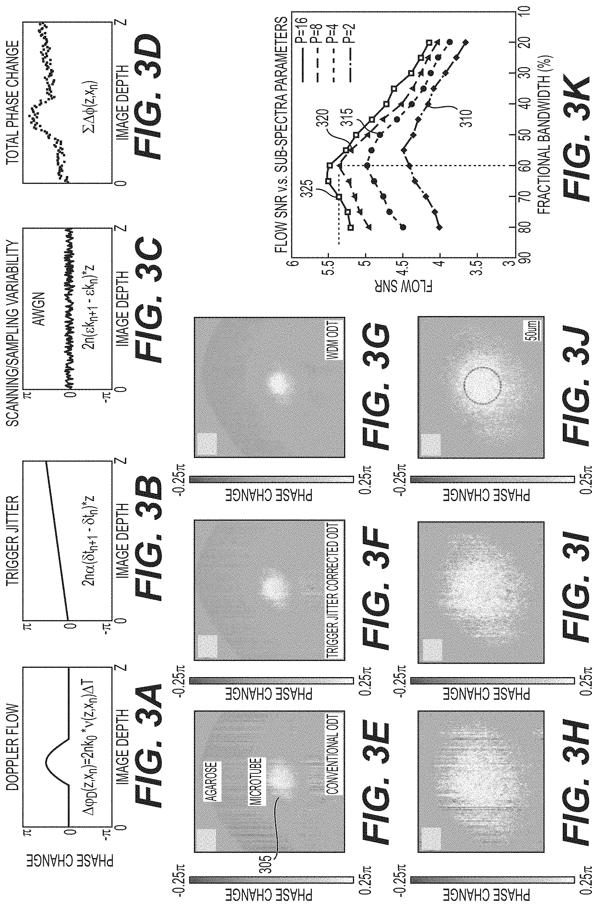 Patent US11771321 Figure 3 – System, method, and computer-accessible medium for subsurface capillary flow imaging by wavelength-division-multiplexing swept-source optical doppler tomography