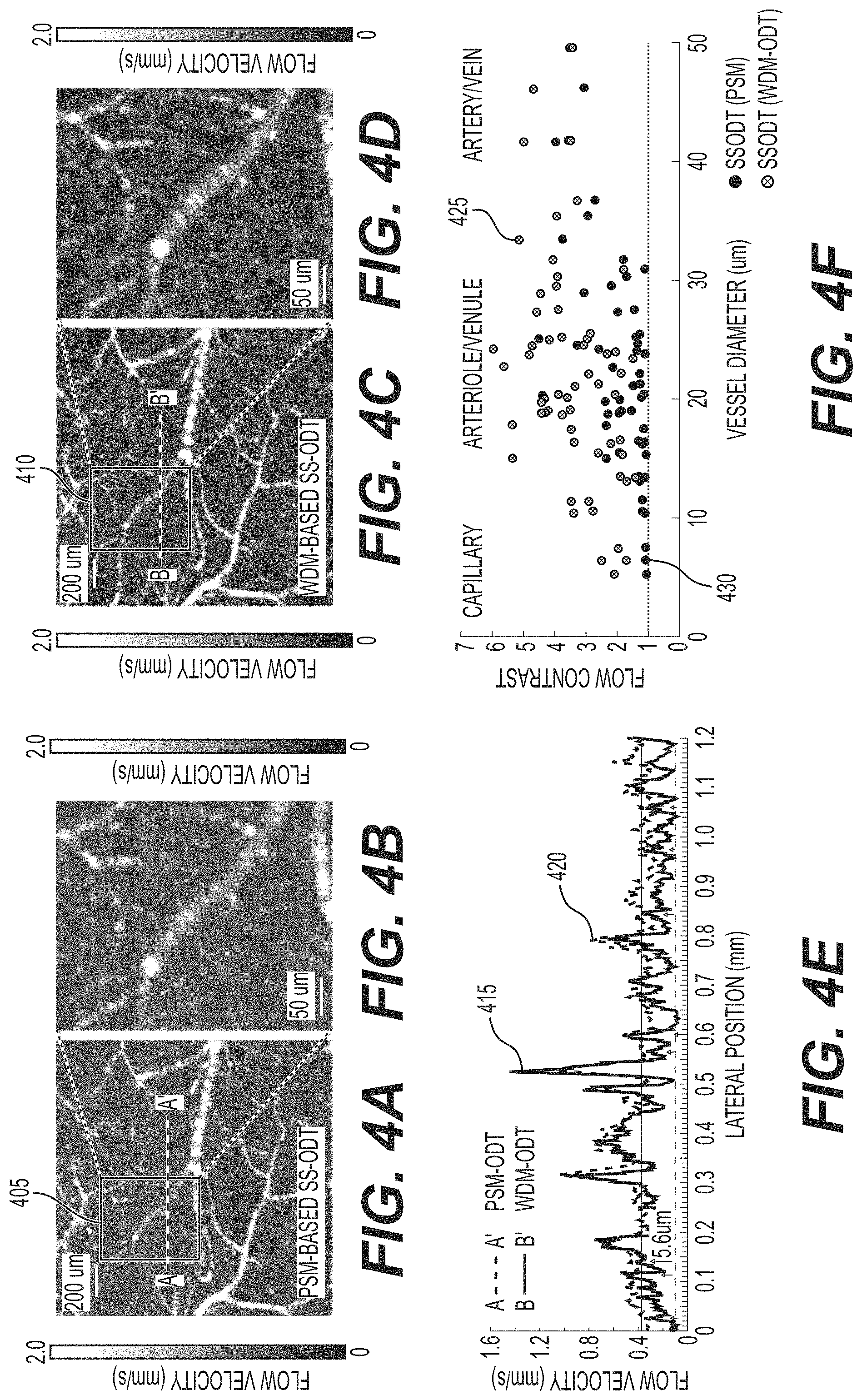 Patent US11771321 Figure 4 – System, method, and computer-accessible medium for subsurface capillary flow imaging by wavelength-division-multiplexing swept-source optical doppler tomography